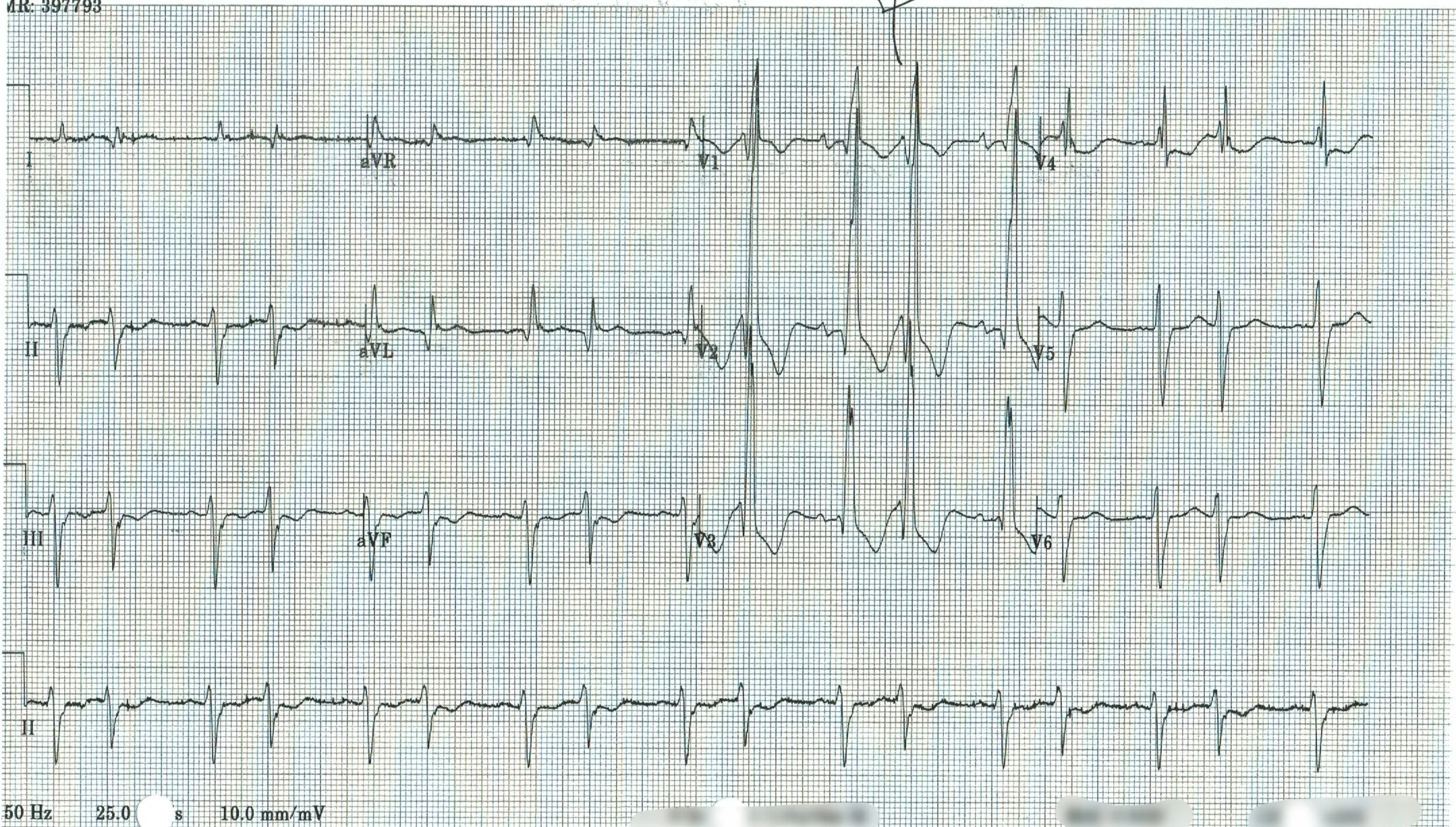 EKG 11.jpeg