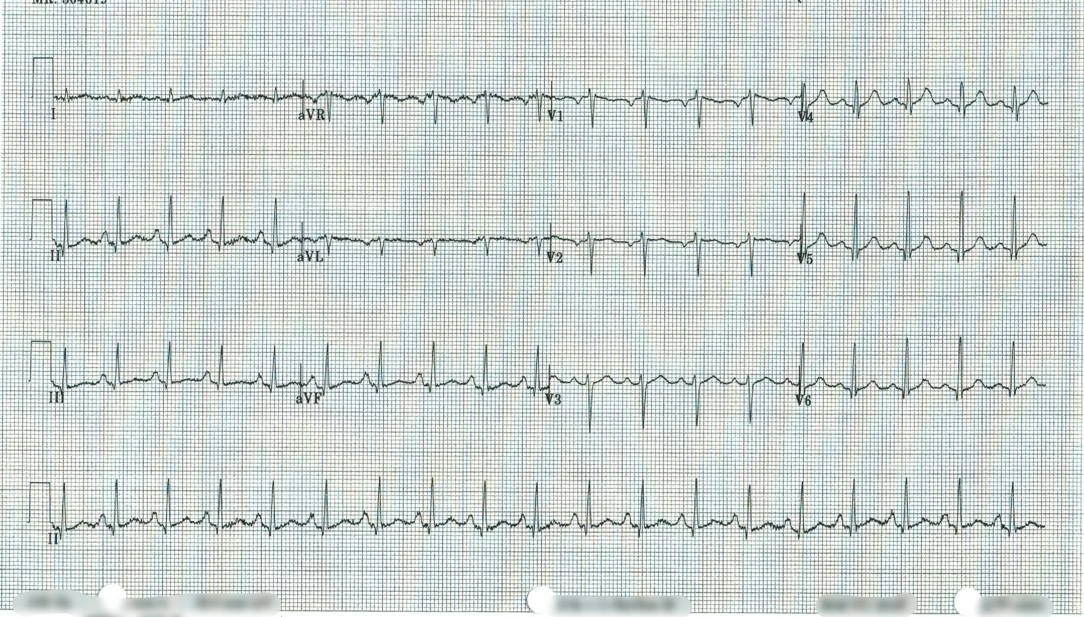 EKG 12.jpeg