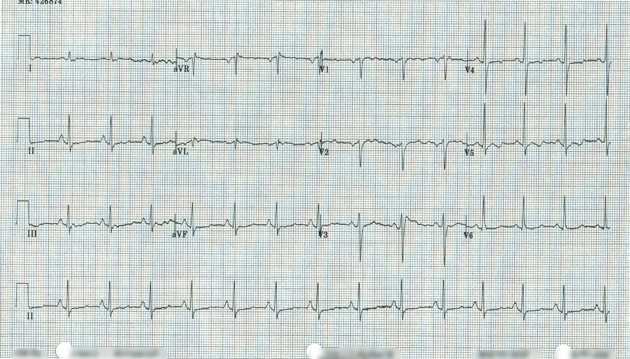 EKG 13.jpeg