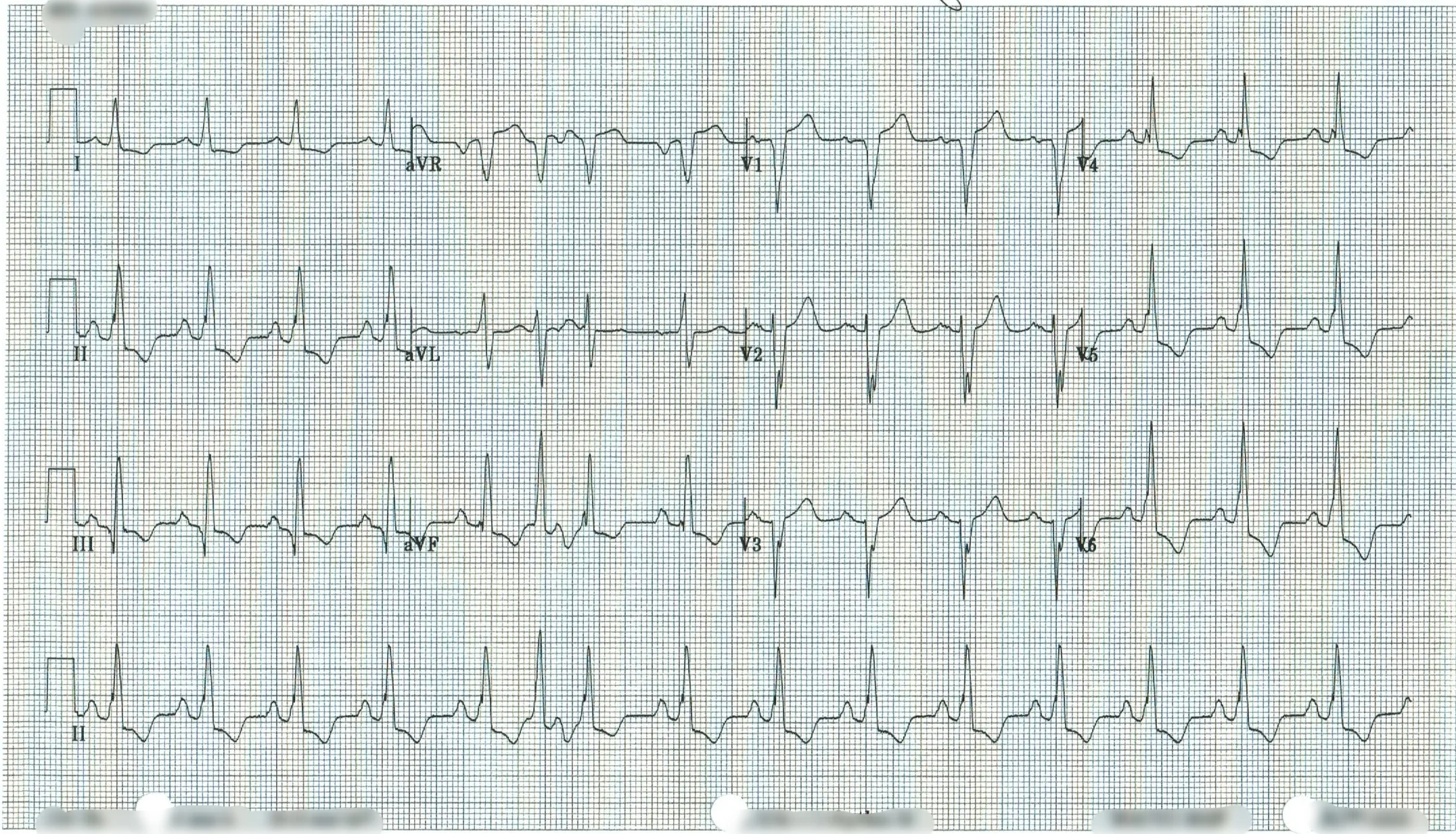 EKG 14.jpeg