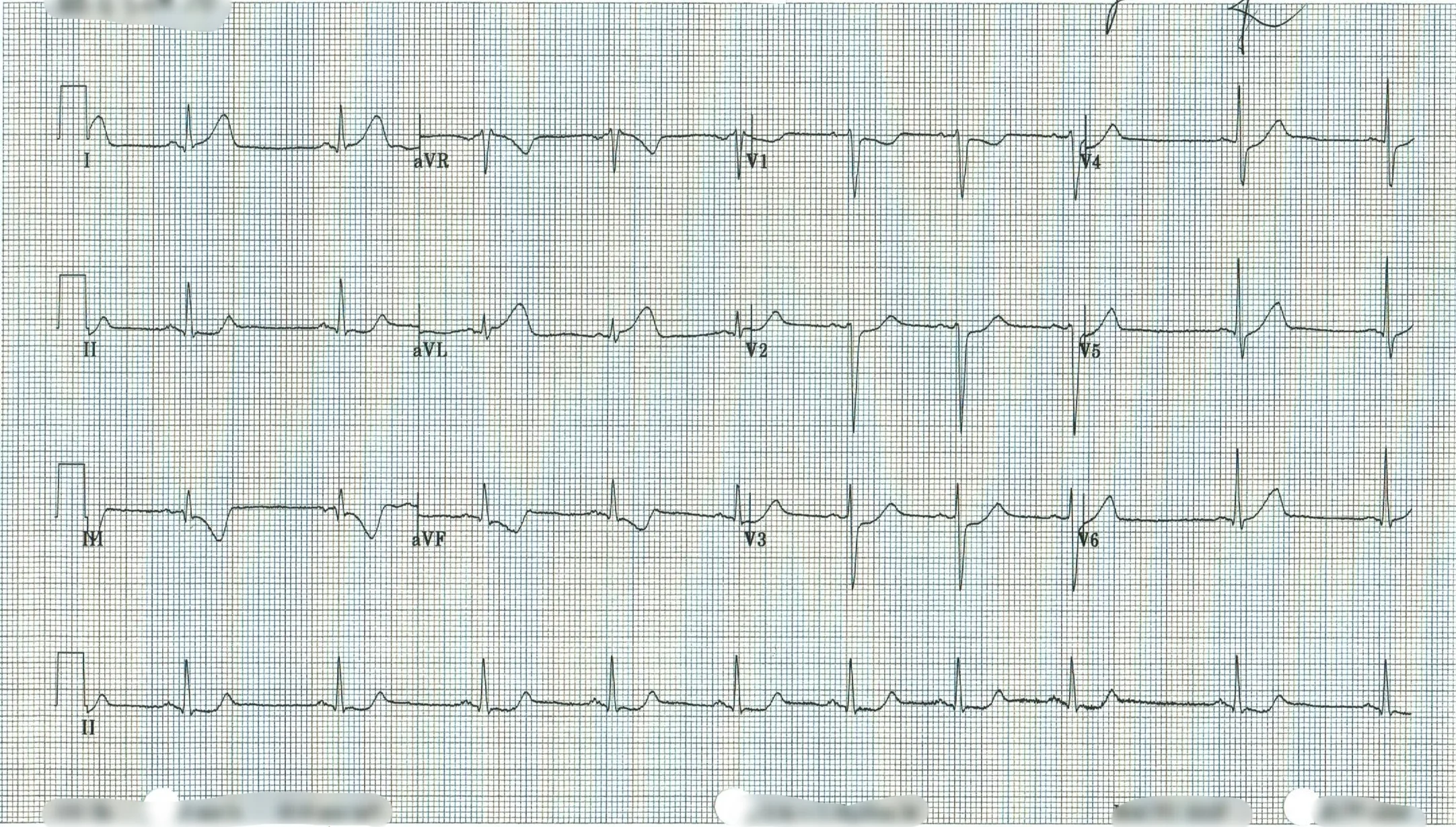 EKG 15.jpeg