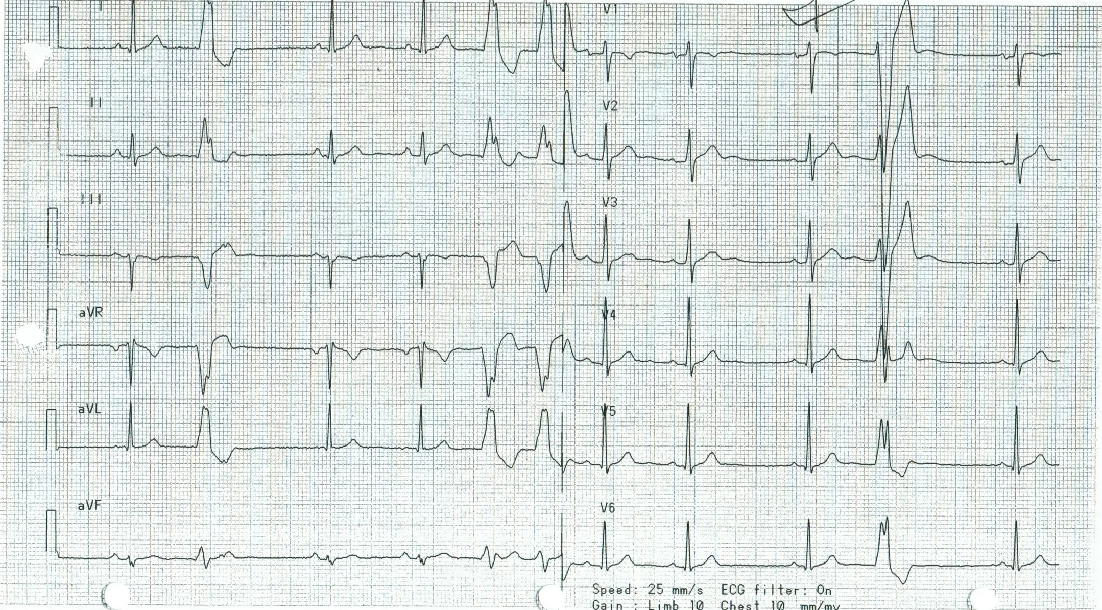 EKG 16a.jpeg