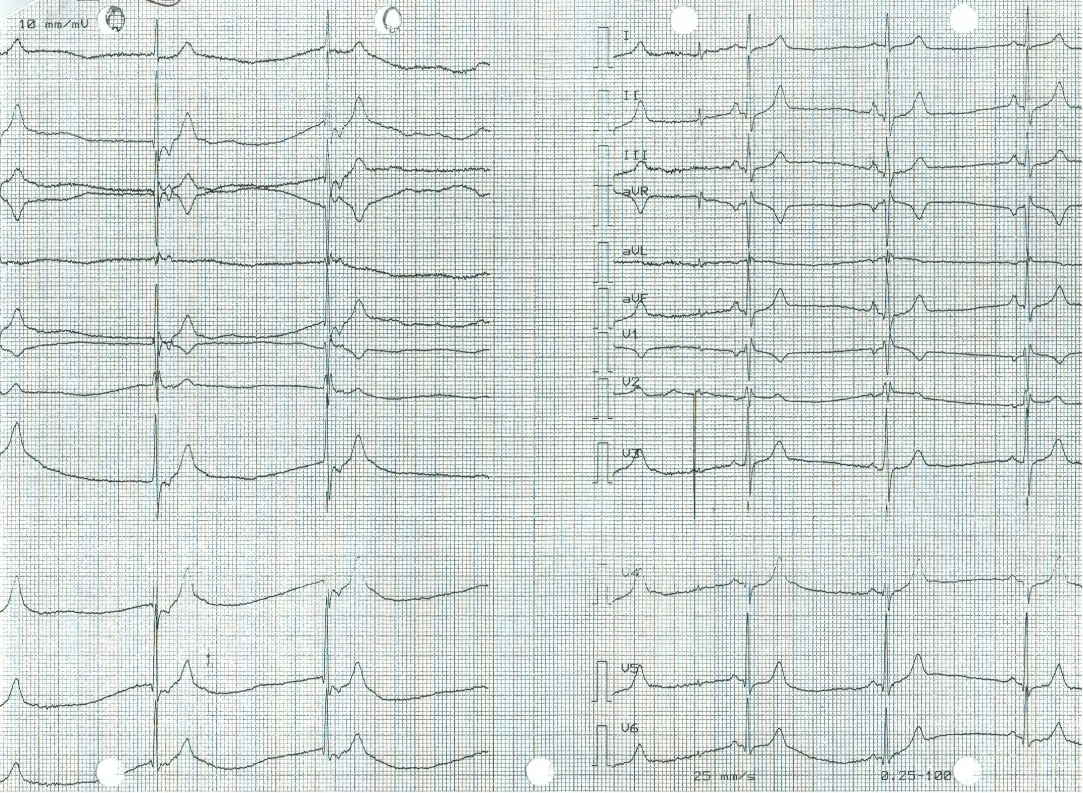 EKG 16b.jpeg