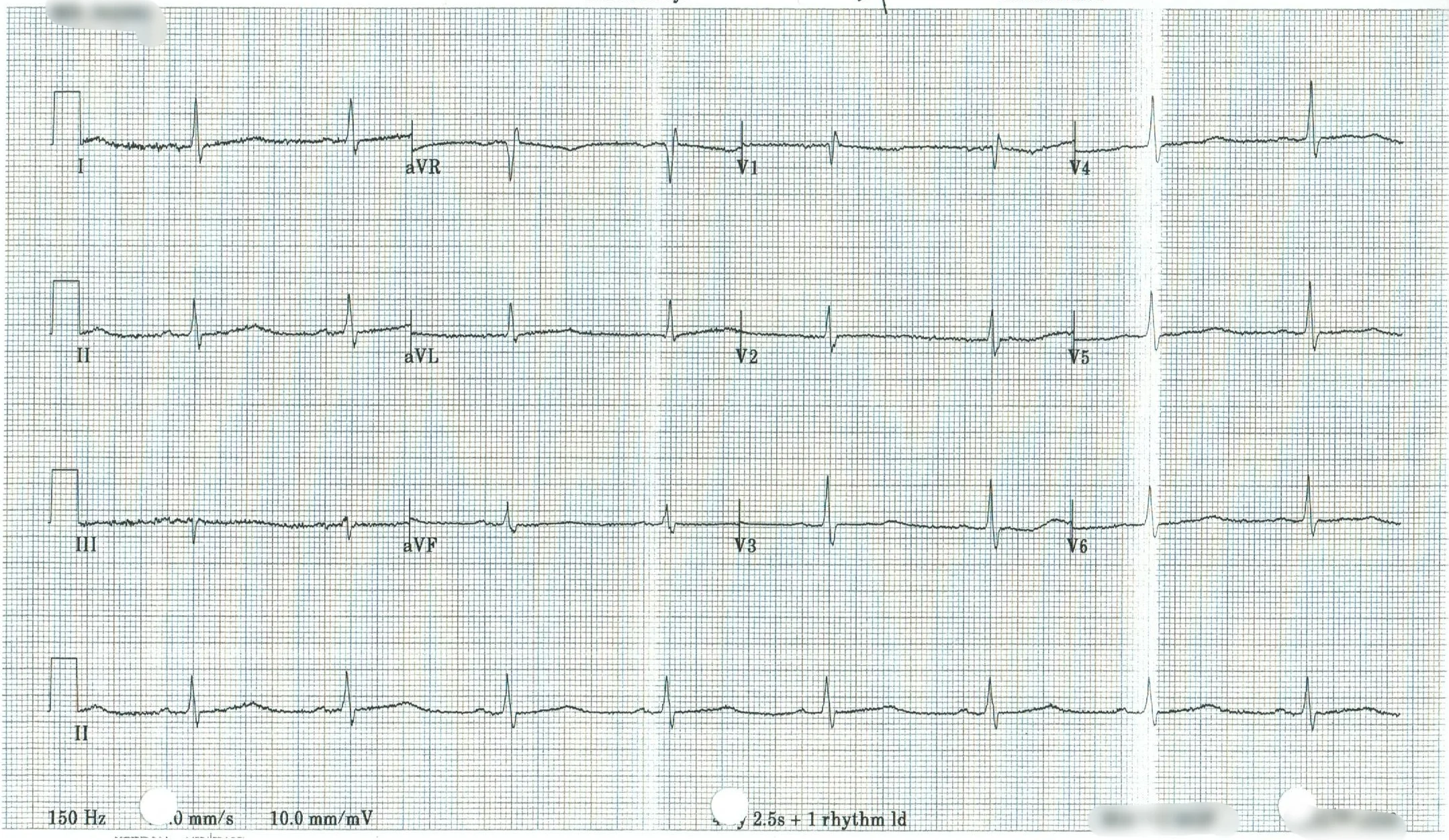 EKG 17.jpeg