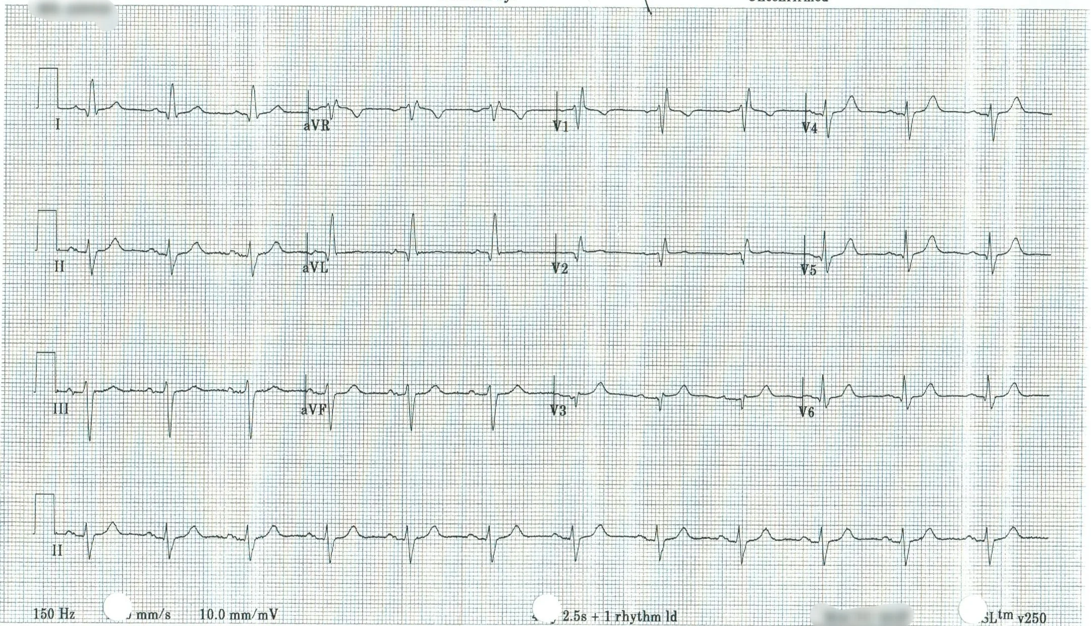 EKG 19.jpeg