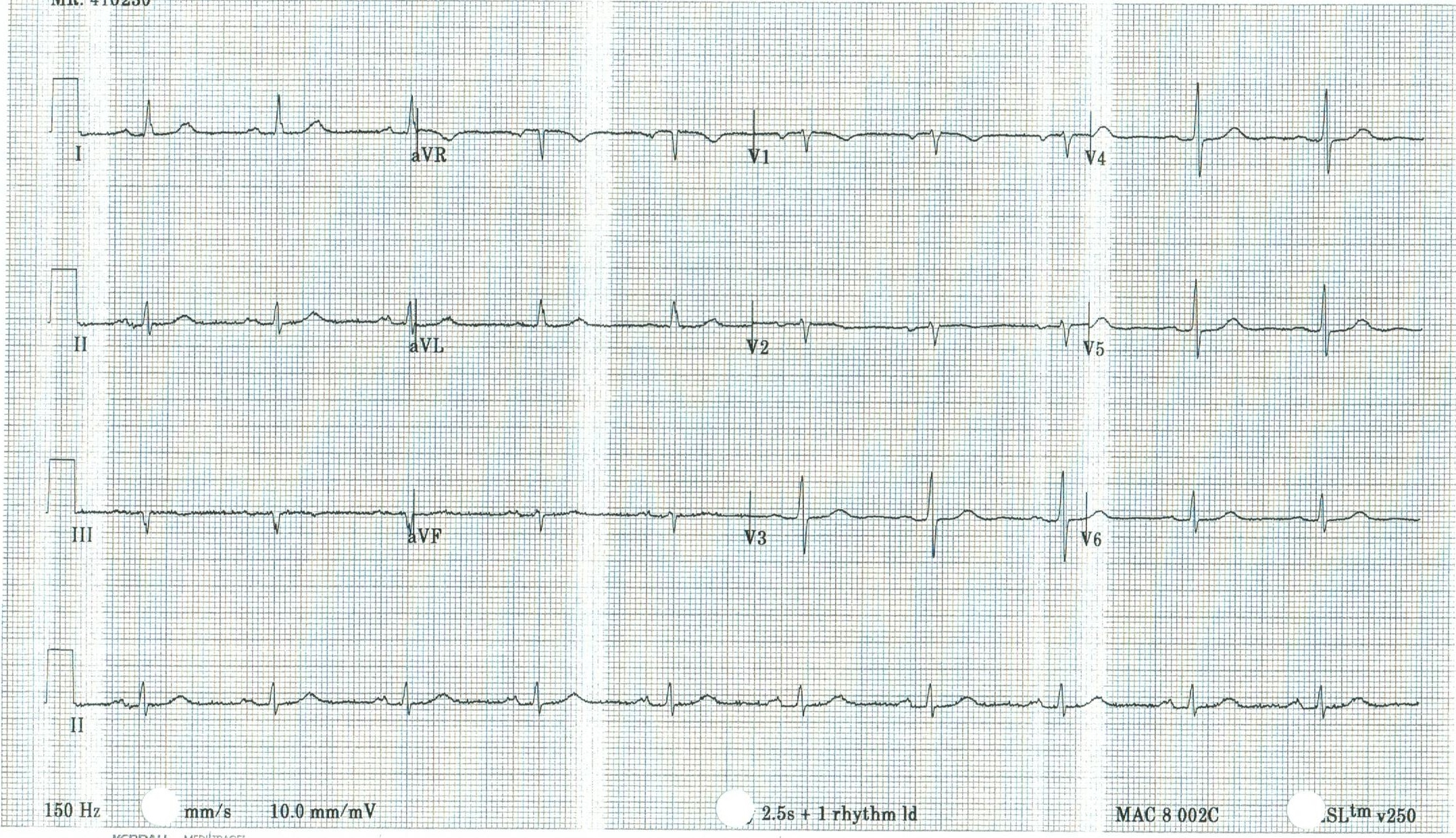 EKG 20.jpeg