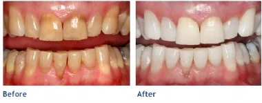 Kor whitening image.jpg