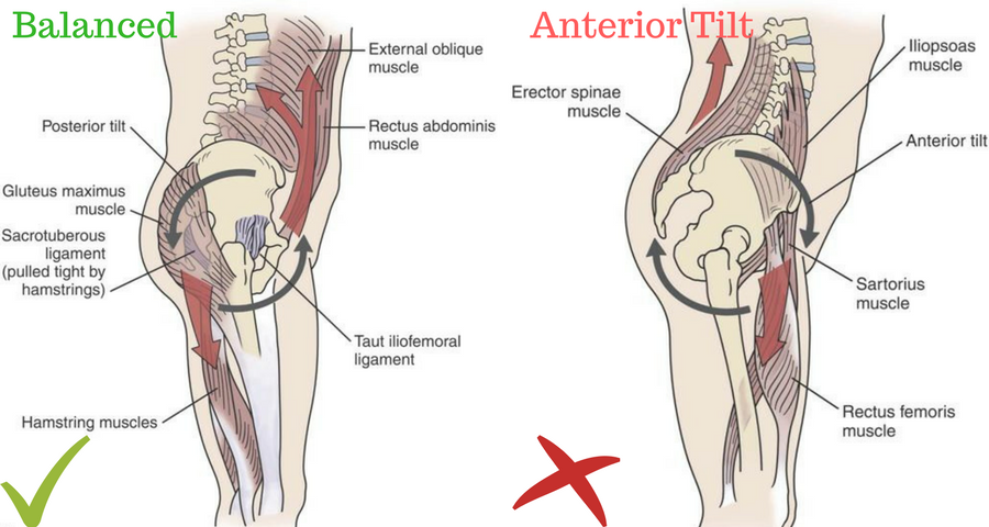 Stop Stretching Tight Hamstrings!