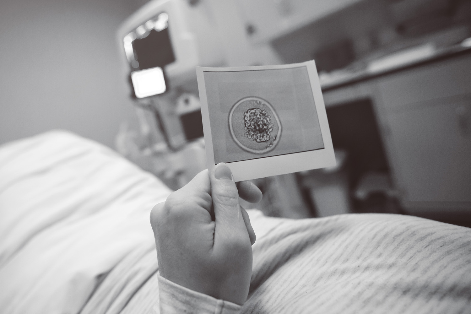 Best baby picture ever... our embryo just before transfer, waking up from its slumber. 