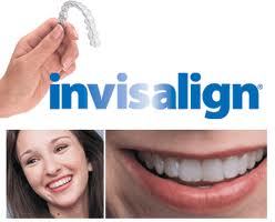 invisalign.jpeg