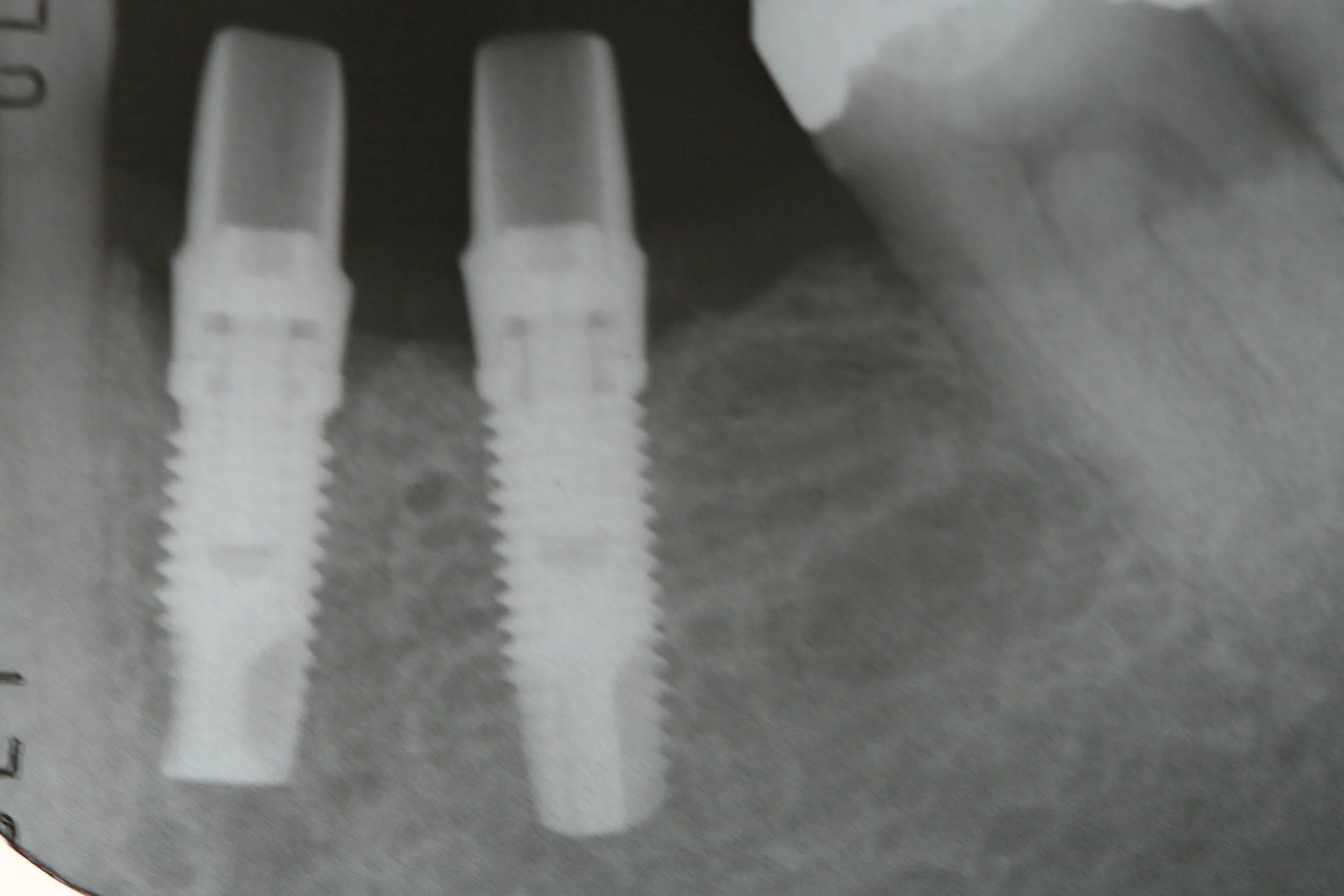 patientpics1 082.jpeg