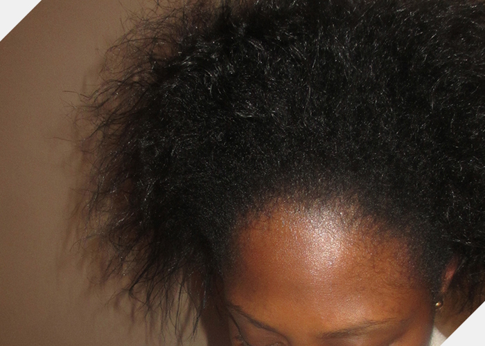 Mo / Natural roots with relaxer on the ends