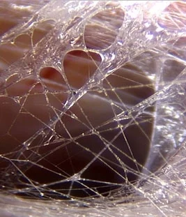 fascia_up_close.jpg