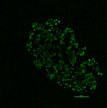 fig 3. Healthy pancreatic islet - showing insulin production.