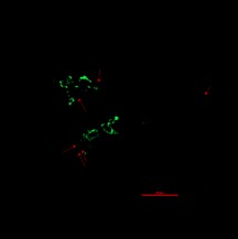 fig 4. Pancreatic islet with type 1 diabetes - showing insulin production. Provided by Dr Anneliese Flatt: clinical research centre Newcastle RVI.