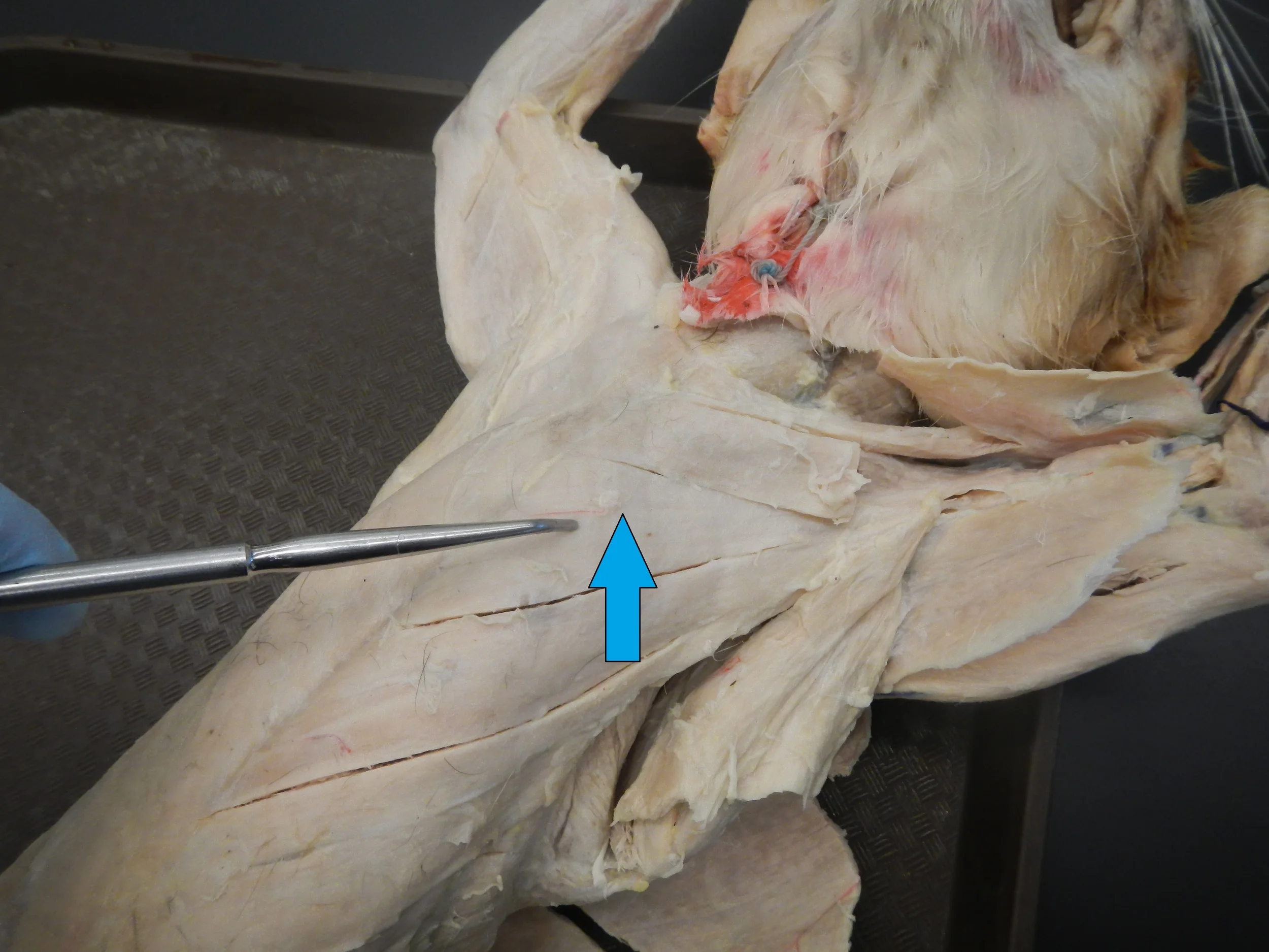 Pectoralis Major O -
Clavicle (head and medial portion) and costal cartilage of ribs 1-6 I -
Greater tubercle and bicipital groove of humerus F -
Shoulder flexion, Adduction and medial rotation of humerus, Horizontal flexion
of arm