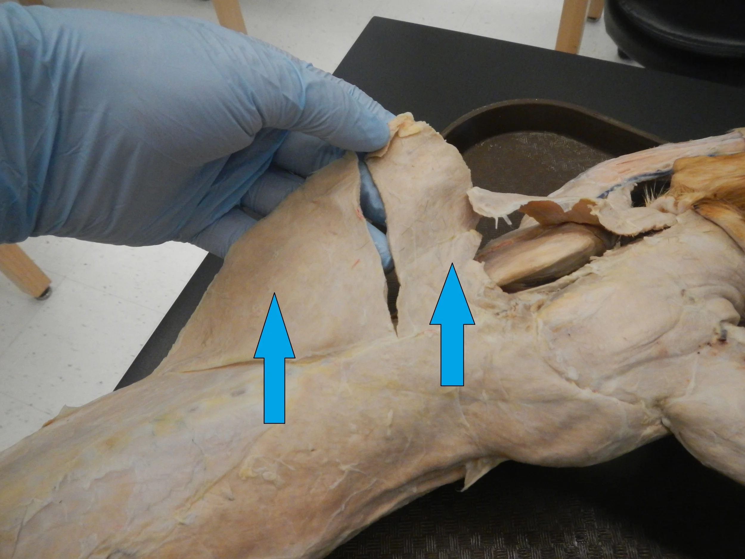 Latissimus Dorsi - Posterior View O - Vertebrae T7-L5, Crests of sacrum, and inferior 4 ribs I - Bicicptal groove of humerus F - Shoulder extension, Adduction and medial rotation of humerus
