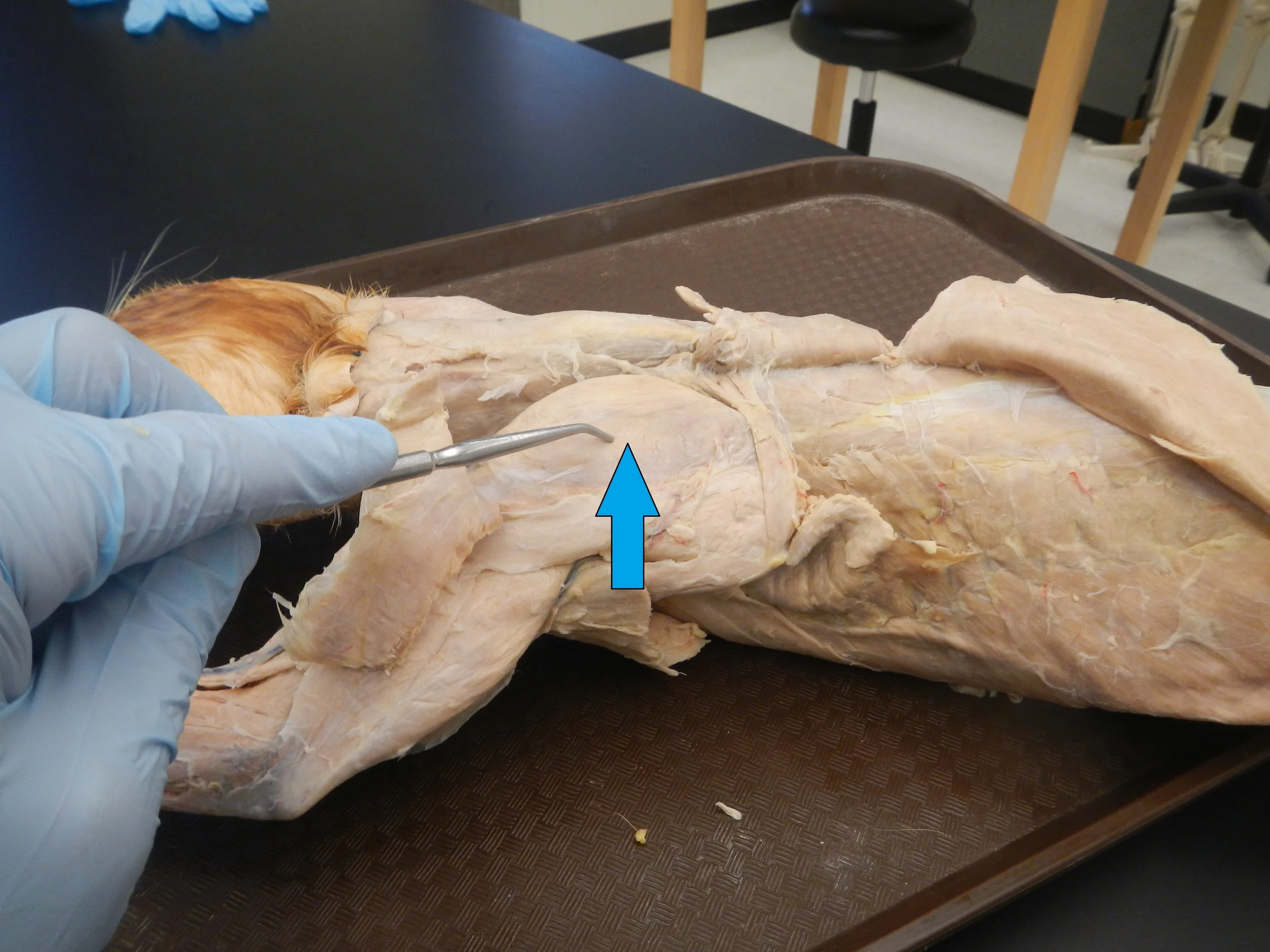 Supraspinatus O -
Supraspinous fossa of scapula I -
Greater tubercle of humerus F -
Stabilizes and provides strength to shoulder joint and initiates abduction