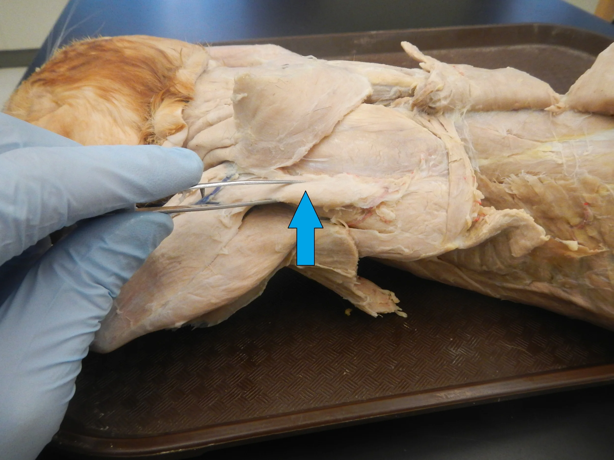 Spinodeltoid O -
Spine of Scapula I -
Deltoid Tuberosity of Humerus F -
Extension of shoulder, lateral rotation of humerus (external rotation)