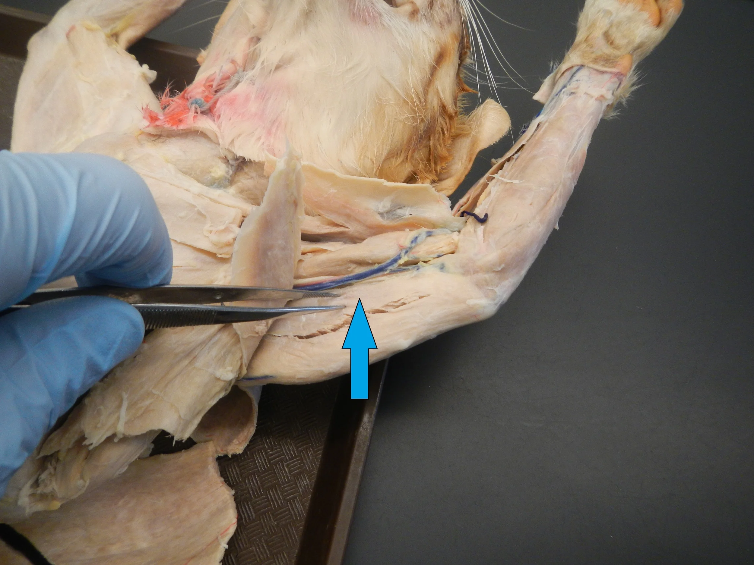 Triceps - Medial Head O -
Posterior/medial aspect of humerus I -
Olecranon process of ulna F - Elbow extension