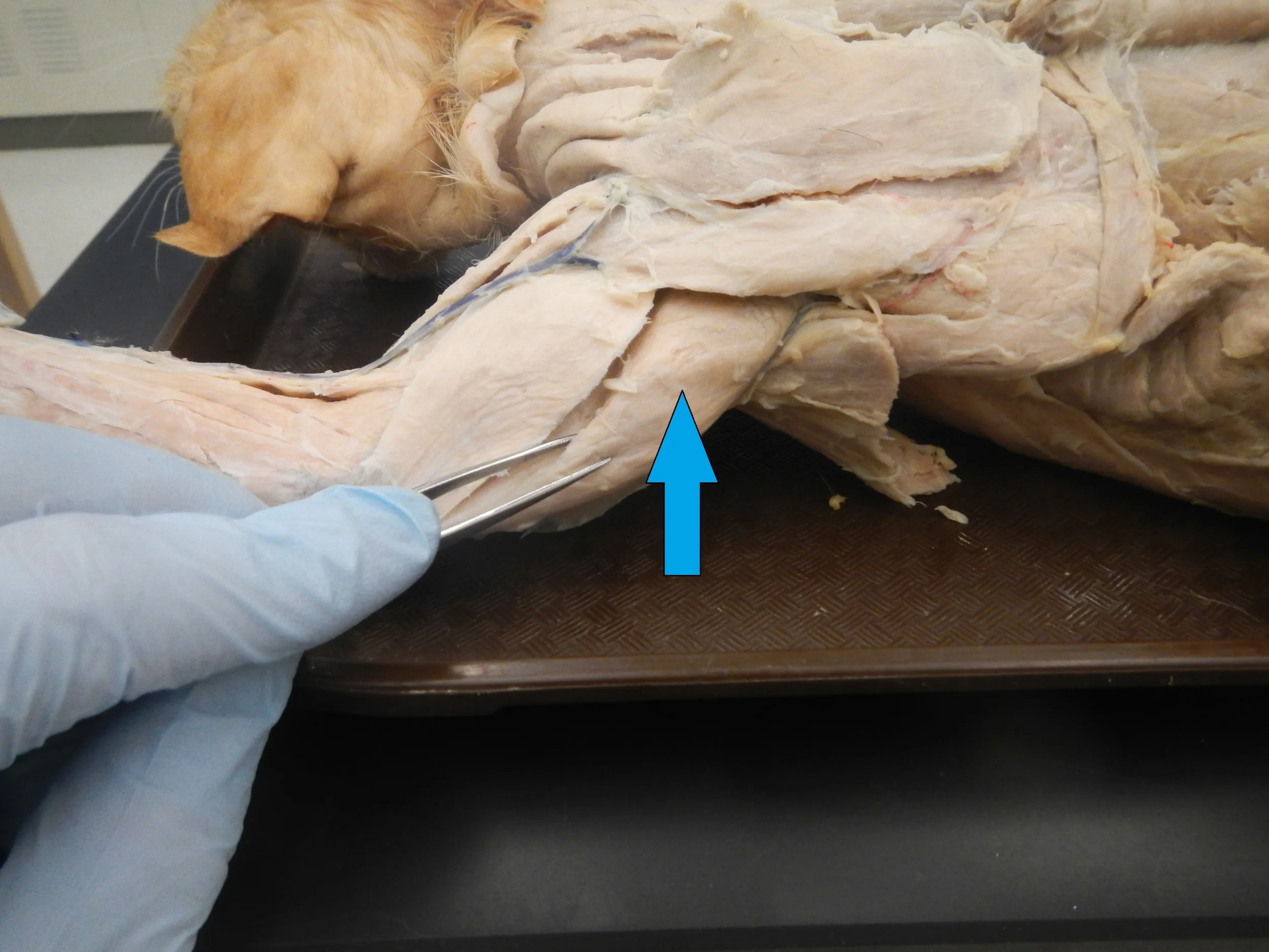 Triceps - Long Head Posterior View