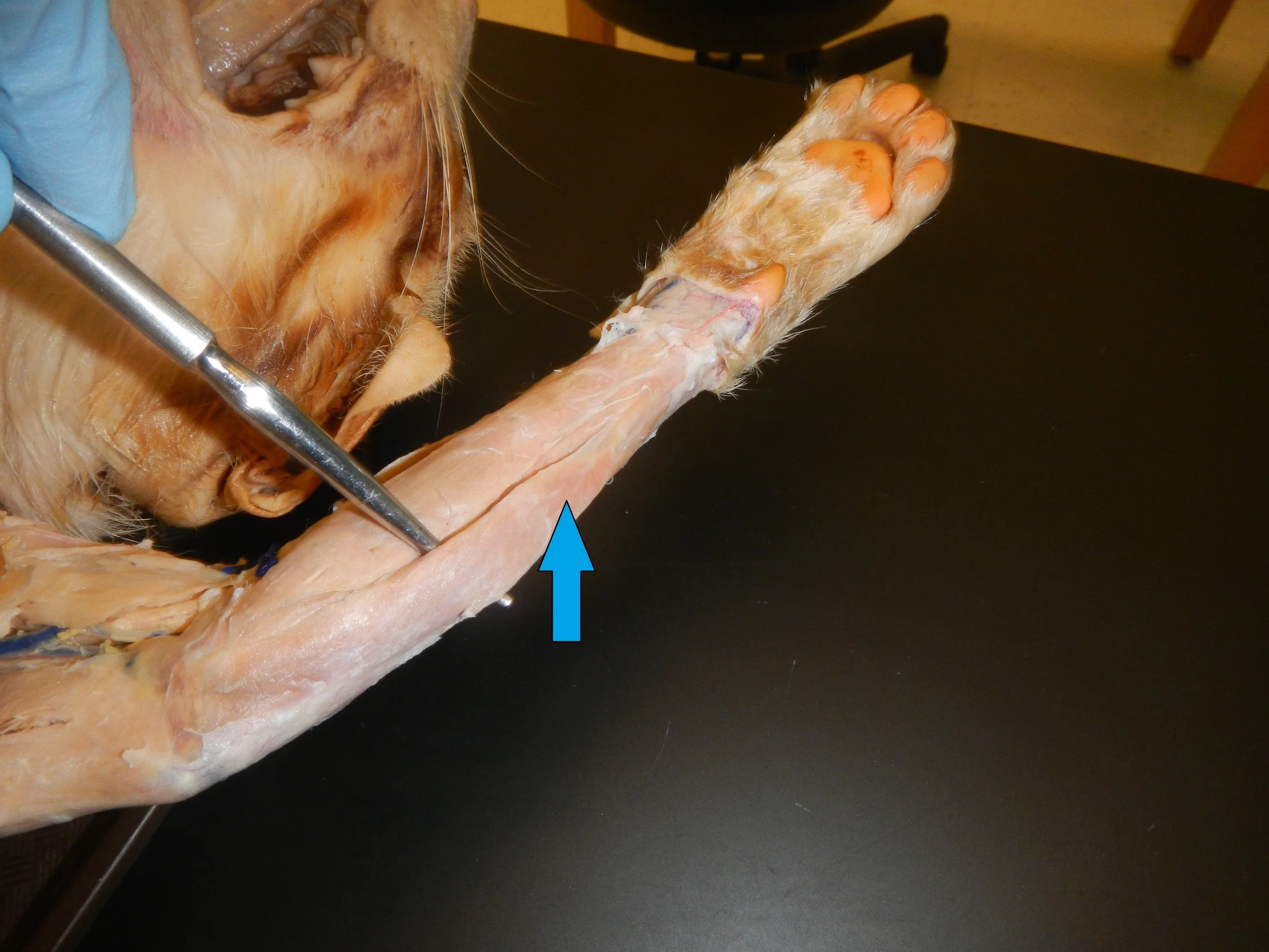 Flexor Carpi Ulnaris O -
Medial epicondyle of humerus I - Pisiform, hook of hamate and base of 5th
metacarpal, passes under flexor retinaculum F -
Elbow flexion, wrist flexion and adduction