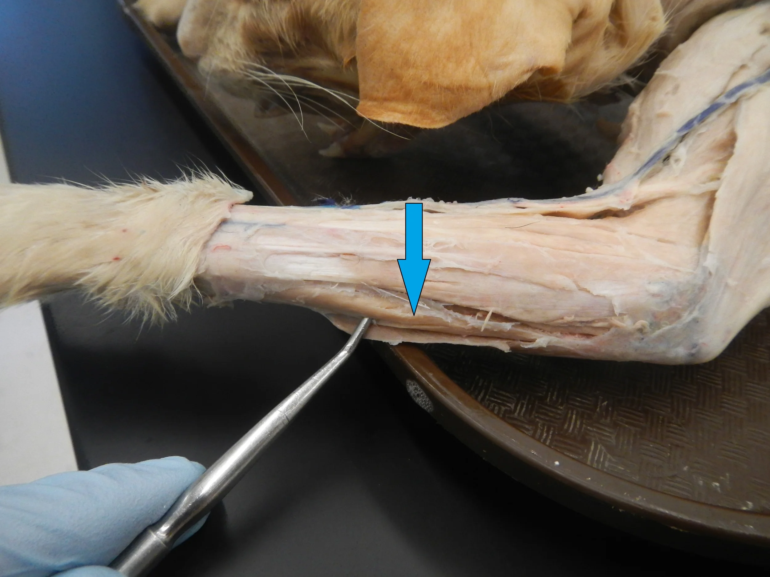 Extensor Carpi Ulnaris O -
Lateral epicondyle of humerus I -
Base of 5th metacarpal F -
Wrist extension and adduction