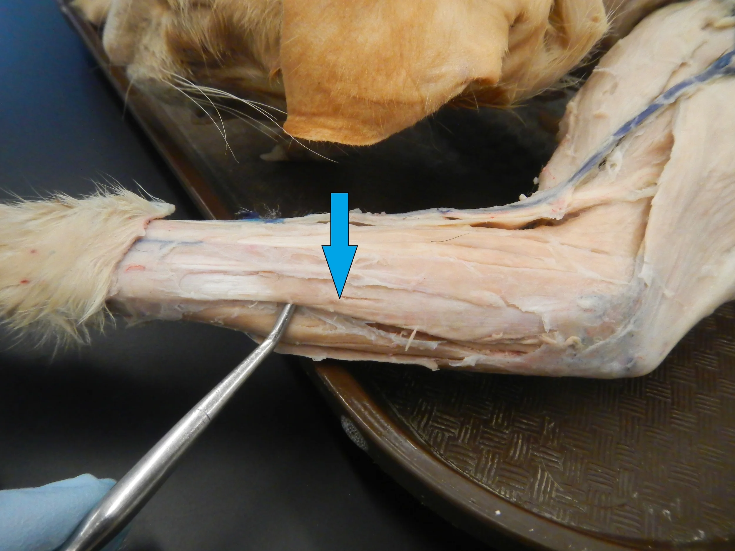 Extensor Digitorum Lateralis - Not in Humans