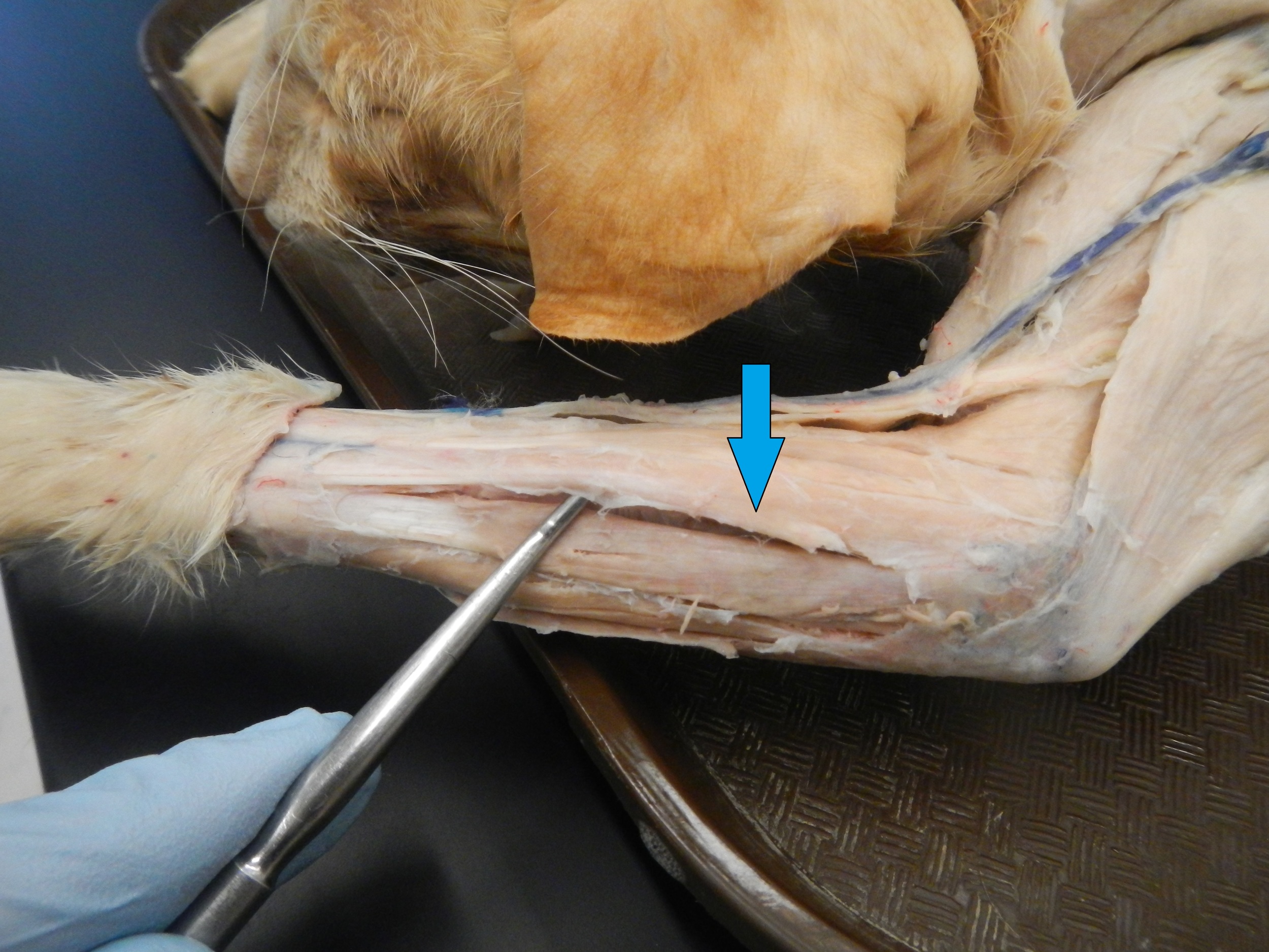 Extensor Digitorum O -
Lateral epicondyle of humerus I -
Distal and middle phalanges of each finger F -
Wrist extension, metacarpal and interphalangeal extension
