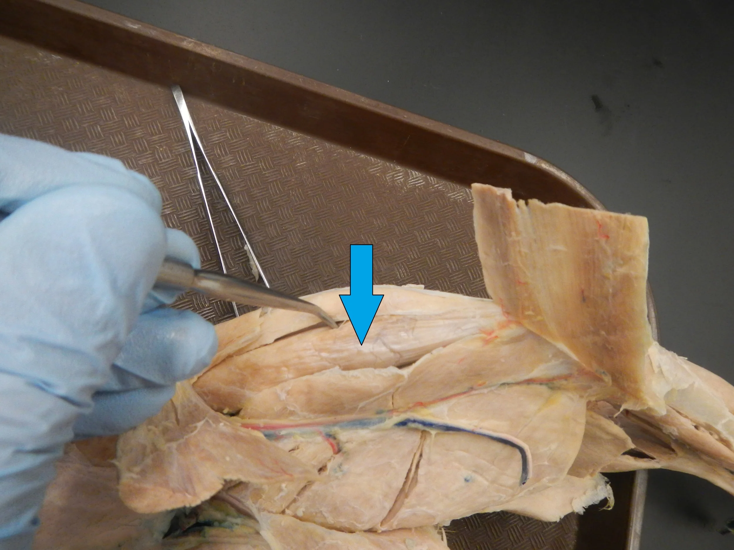 Rectus Femoris O -
Anterior inferior iliac spine I -
Patella via quadriceps tendon, then tibial tuberosity via patellar tendon F -
Flexion of hip and knee extension