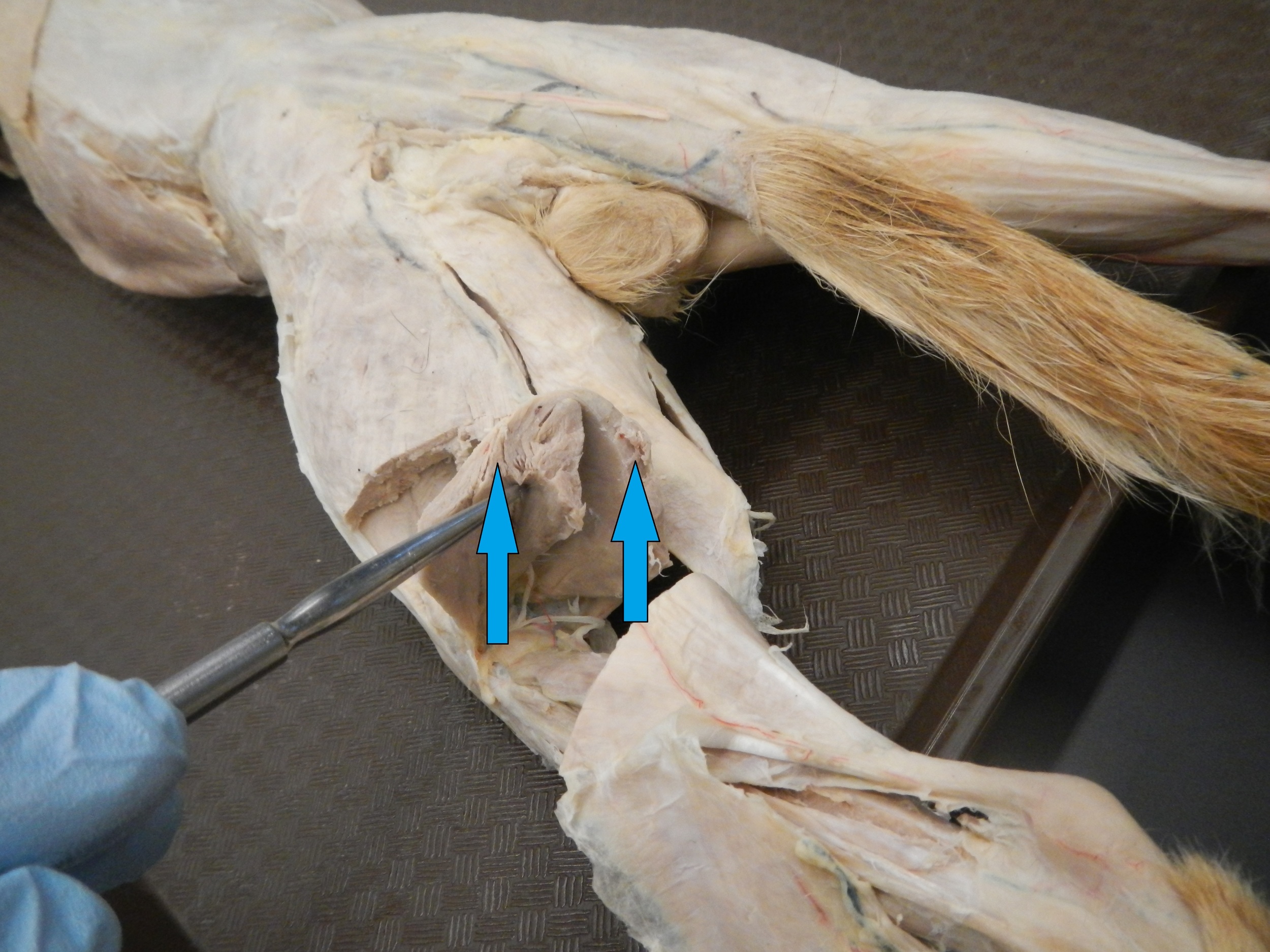 Gastrocnemius O -
Just above lateral and medial femoral condyles I -
Calcaneus via Achilles tendon F -
Knee flexion and ankle plantar flexion