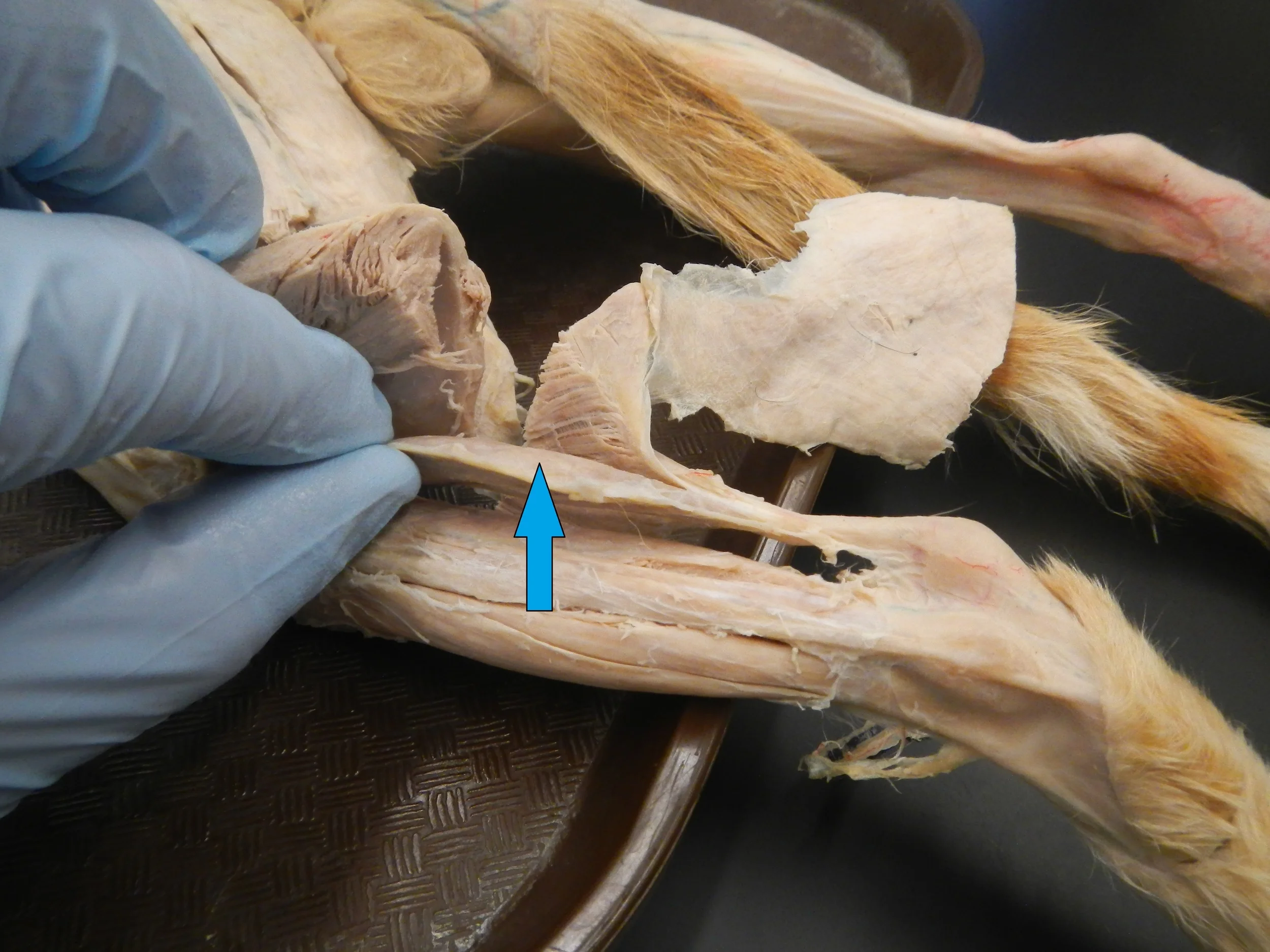 Soleus O -
Head of fibula and medial border of tibia I -
Calcaneus via Achilles tendon F -
Ankle plantar flexion