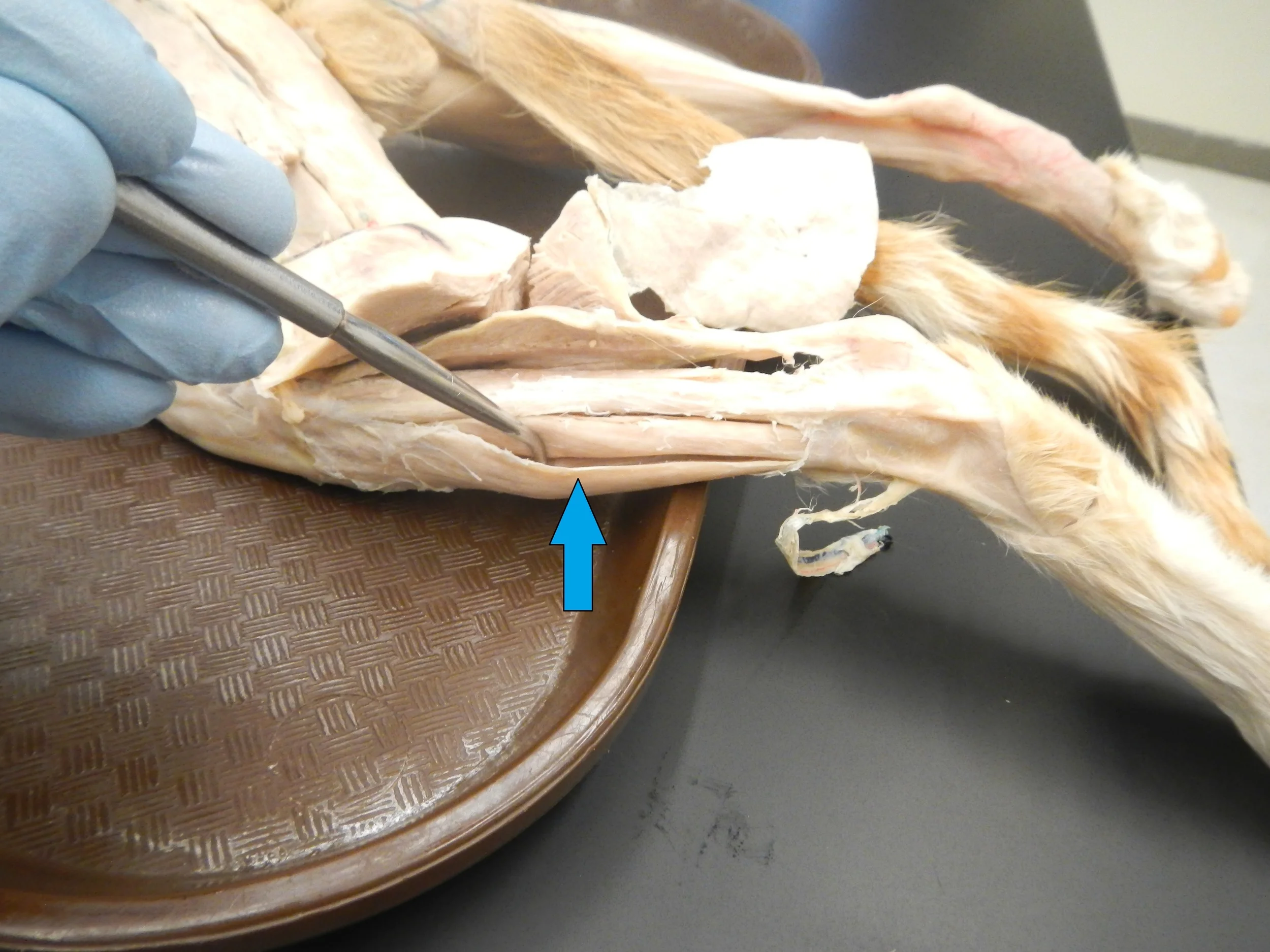 Tibialis Anterior - Lateral View O -
Lateral condyle and anterior upper shaft of tibia I -
Base of 1st metatarsal and medial cuneiform F -
Ankle dorsi flexion and inversion
