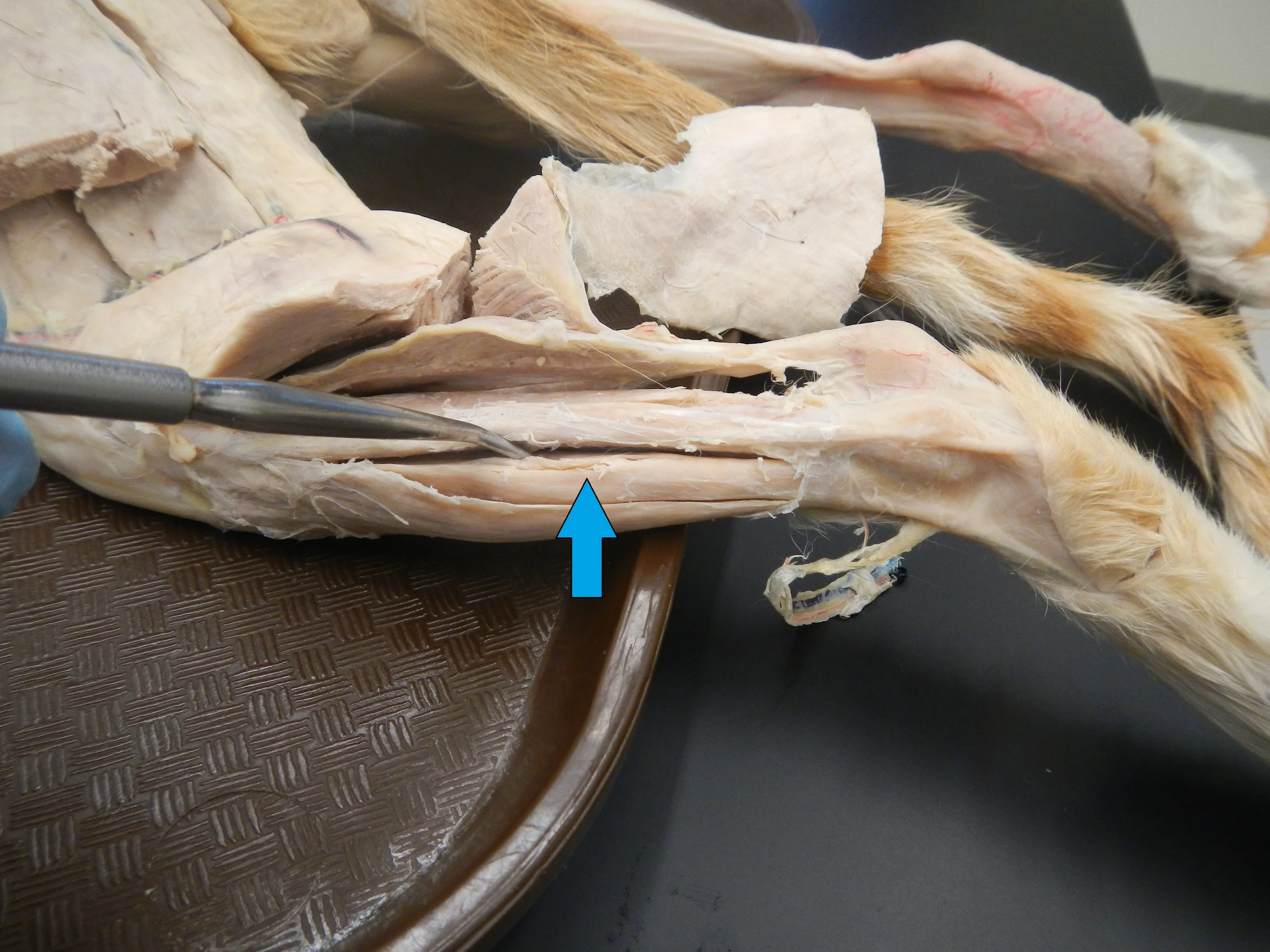 Extensor Digitorum Longus O -
Lateral condyle of tibia, anterior surface of fibula and interosseous
membrane I -
Middle and distal phalanges of lateral 4 digits F -
Ankle dorsiflexion and extension of toes