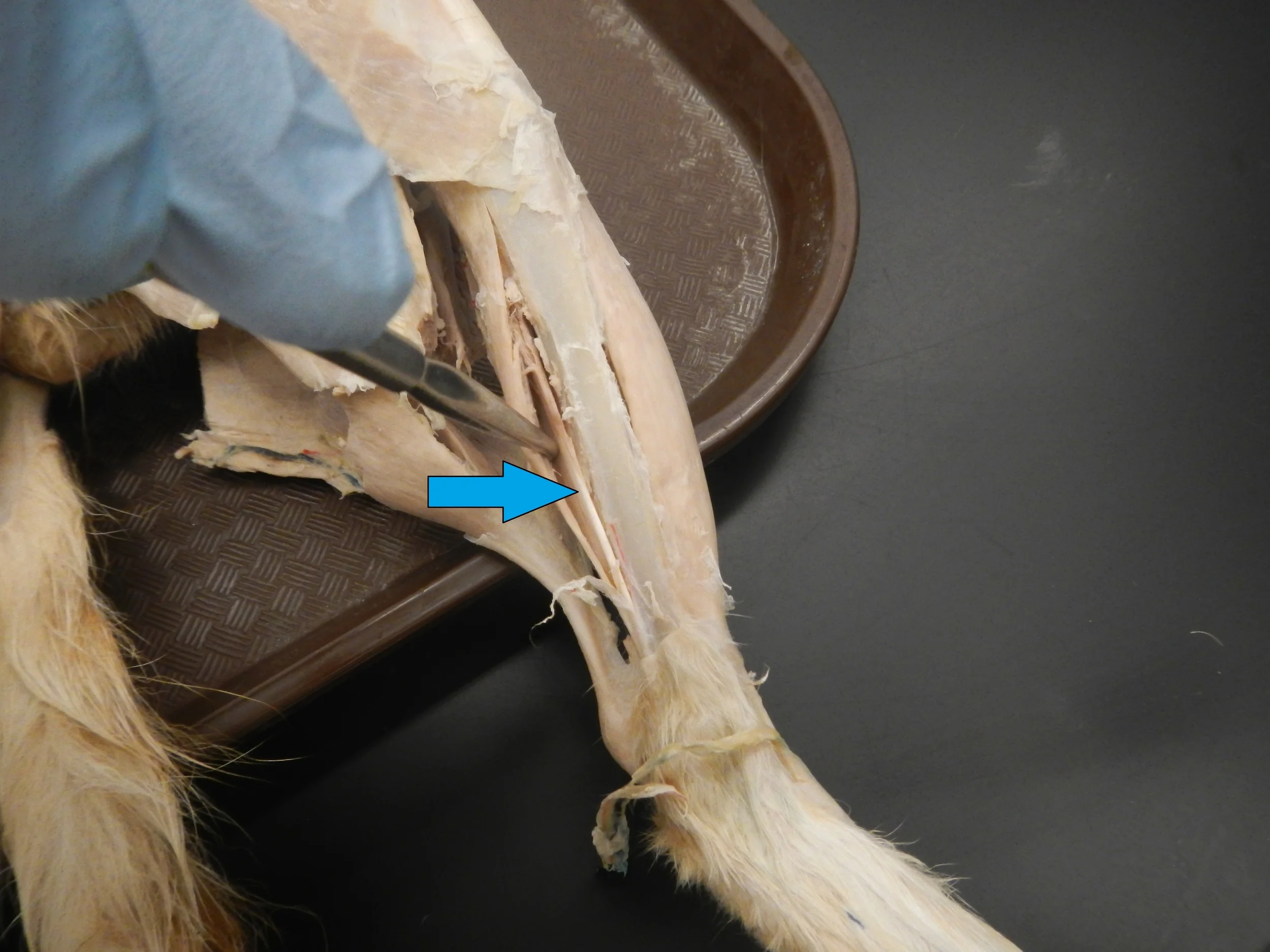 Tibialis Posterior O -
Posterior tibia and fibula and interosseous membrane I -
Broad attachment on plantar surface of foot F -
Ankle plantar flexion and inversion
