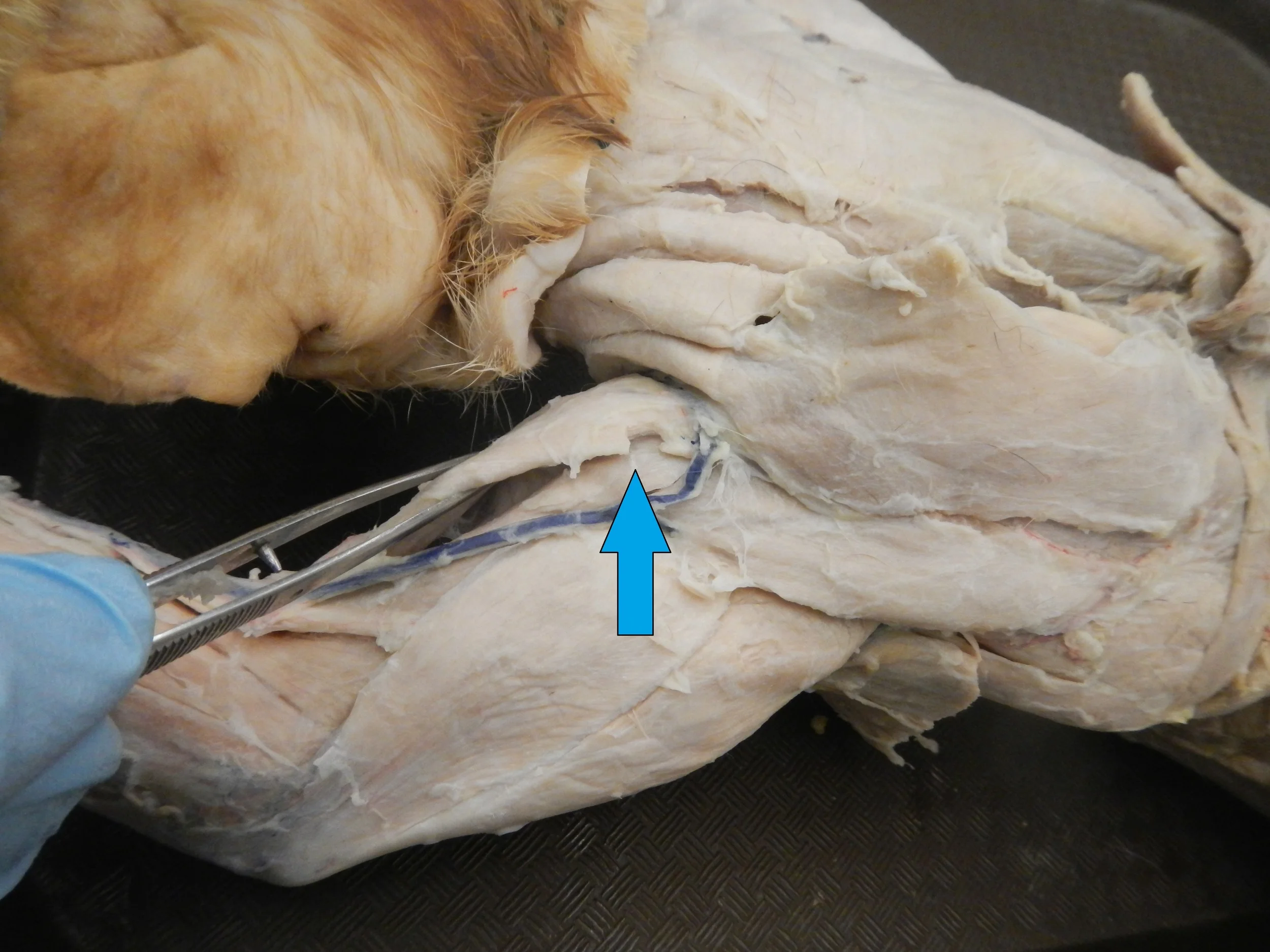 Acromiodeltoid O -
Acromion I -
Deltoid Tuberosity of Humerus F -
Shoulder abduction