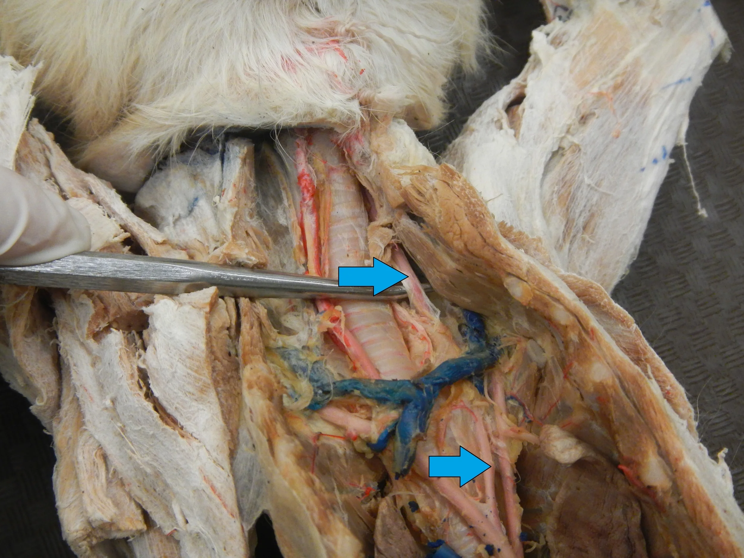 Blue - Left Common Carotid Artery