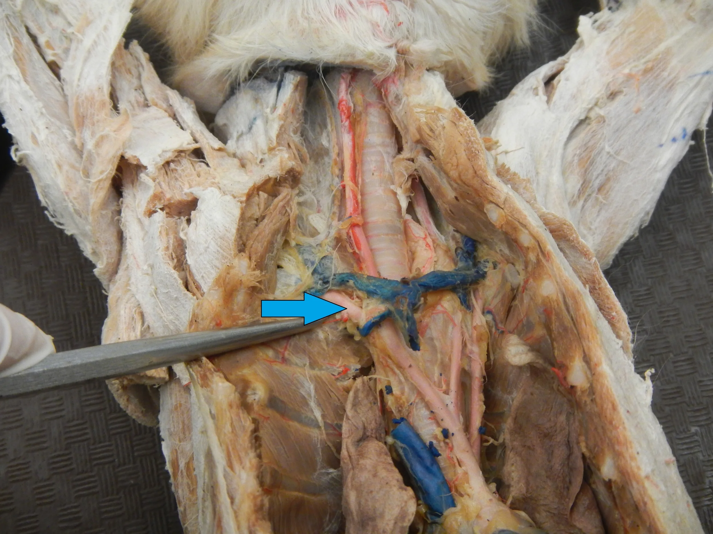 Blue - Right Subclavian Artery