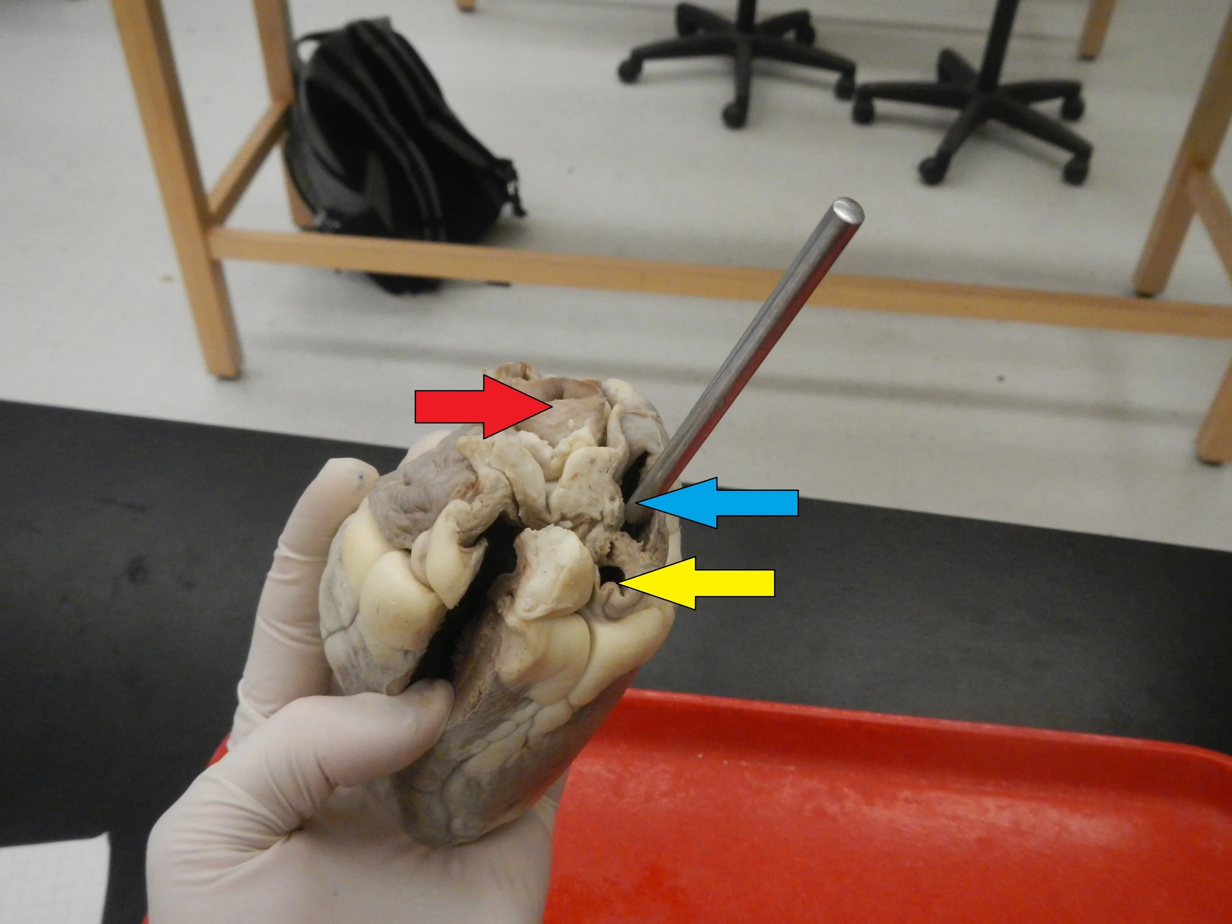 Red - Aorta Blue - Superior Vena Cava Yellow - Inferior Vena Cava