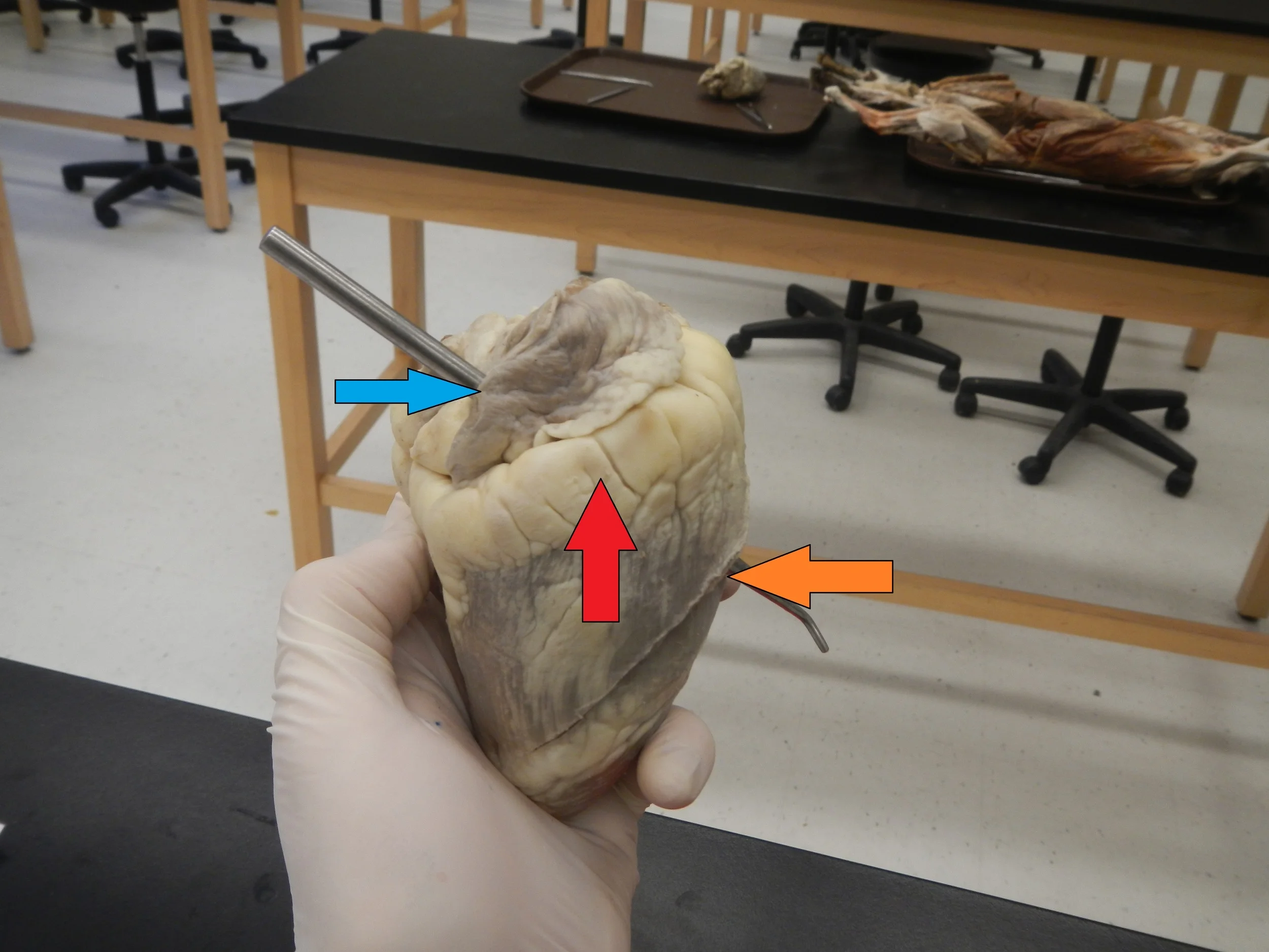 Blue - Superior Vena Cava Red - Right Atrium Orange - Right Ventricle 