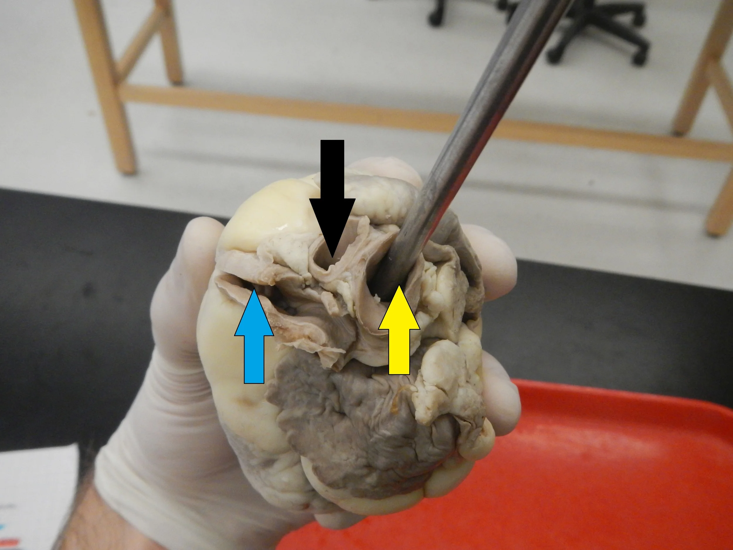 Blue - Pulmonary Artery Yellow - Aorta Black - Brachiocephalic Artery (Will not be tested on)