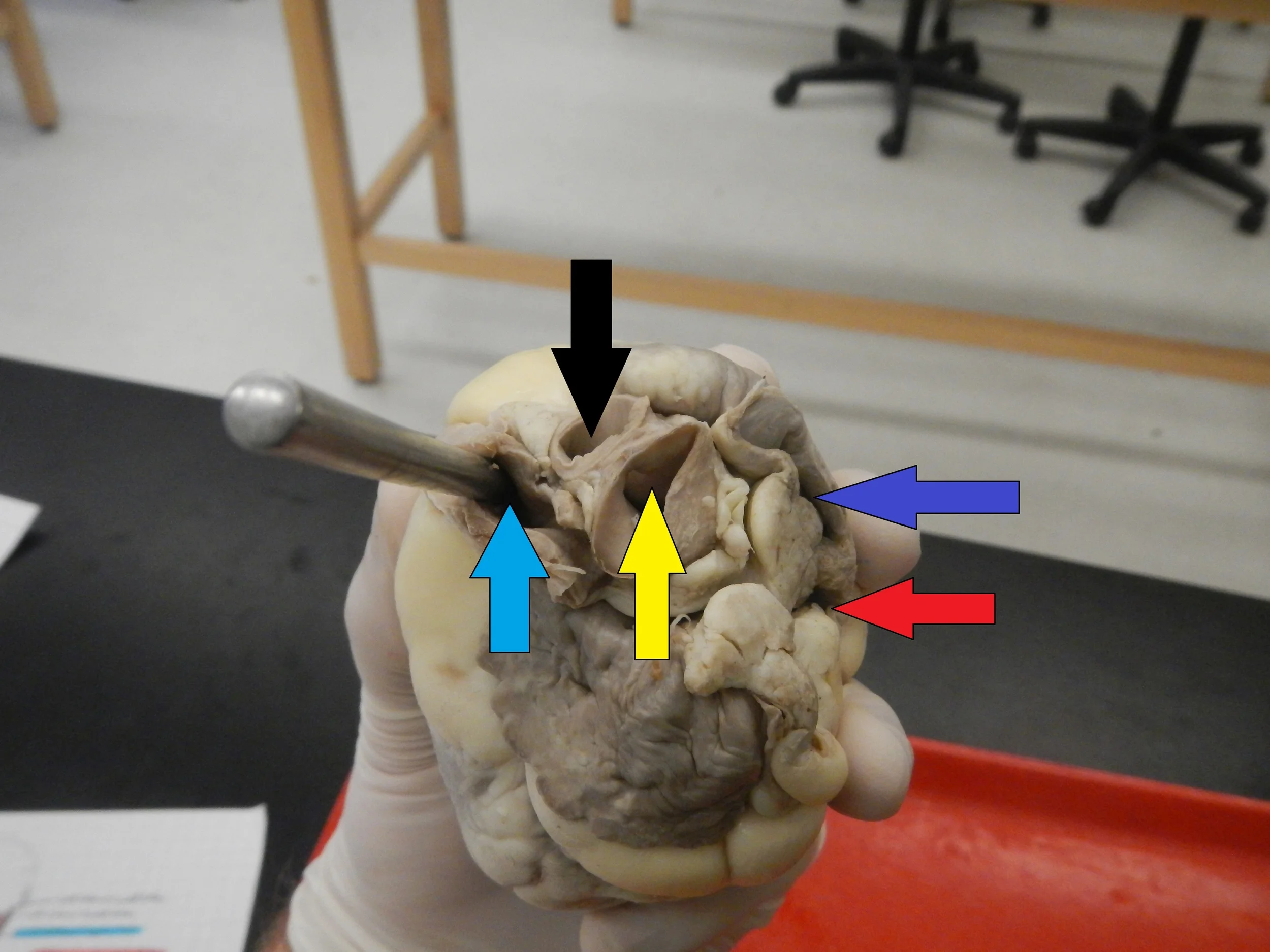 Blue - Pulmonary Artery Yellow - Aorta Black - Brachiocephalic Artery (Will not be tested on) Dark Blue - Superior Vena Cava Red - Inferior Vena Cava