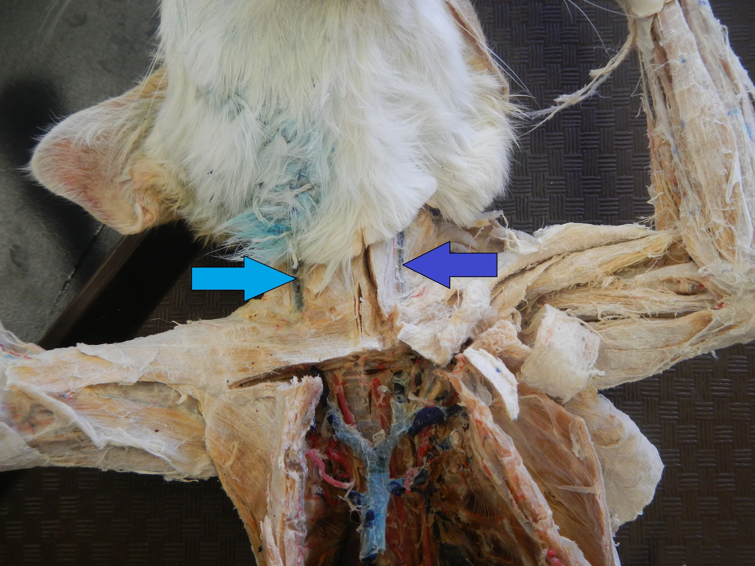 Light Blue - Right External Jugular Vein Dark Blue - Left External Jugular Vein