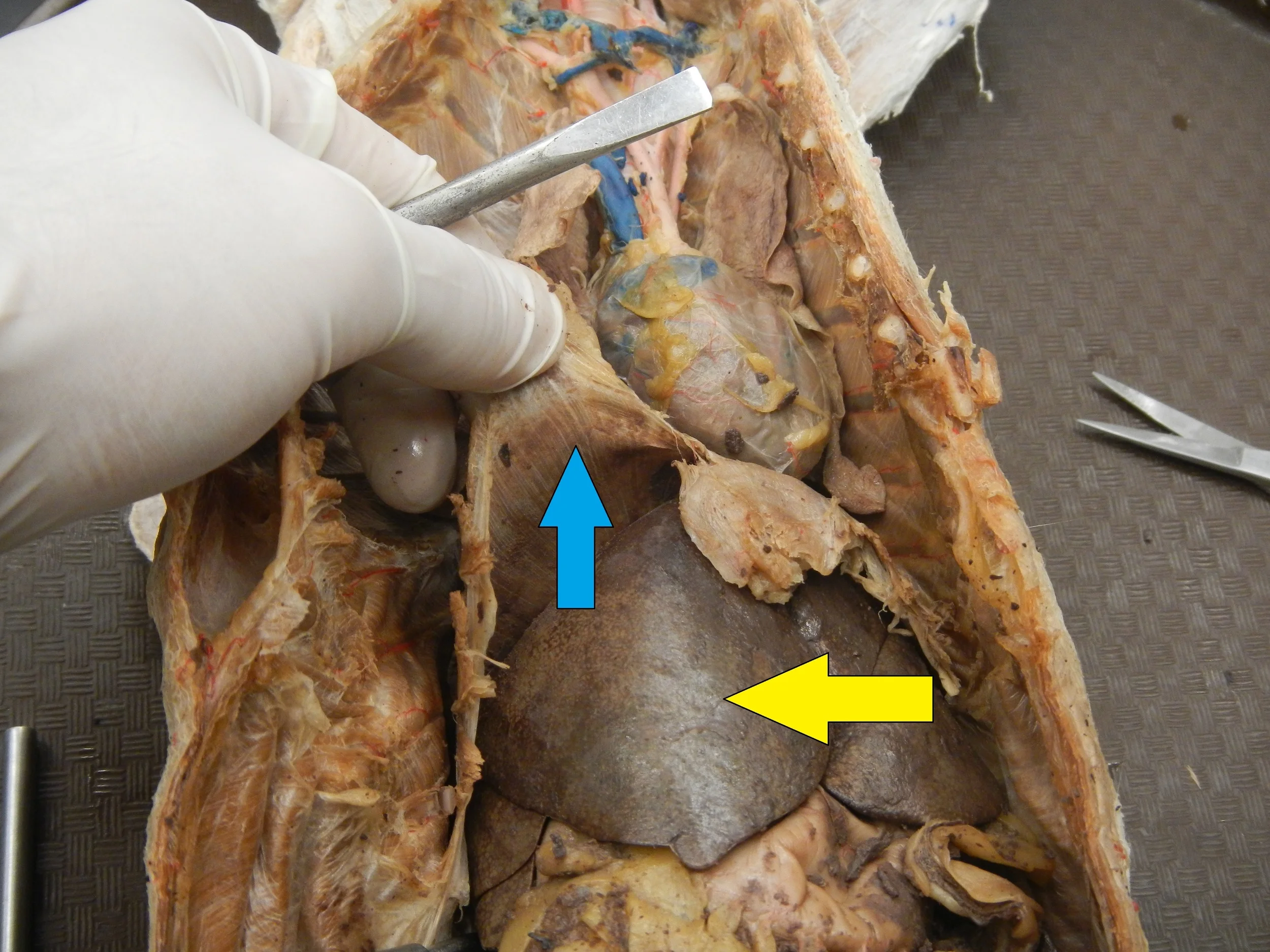 Blue - Diaphragm Yellow - Liver