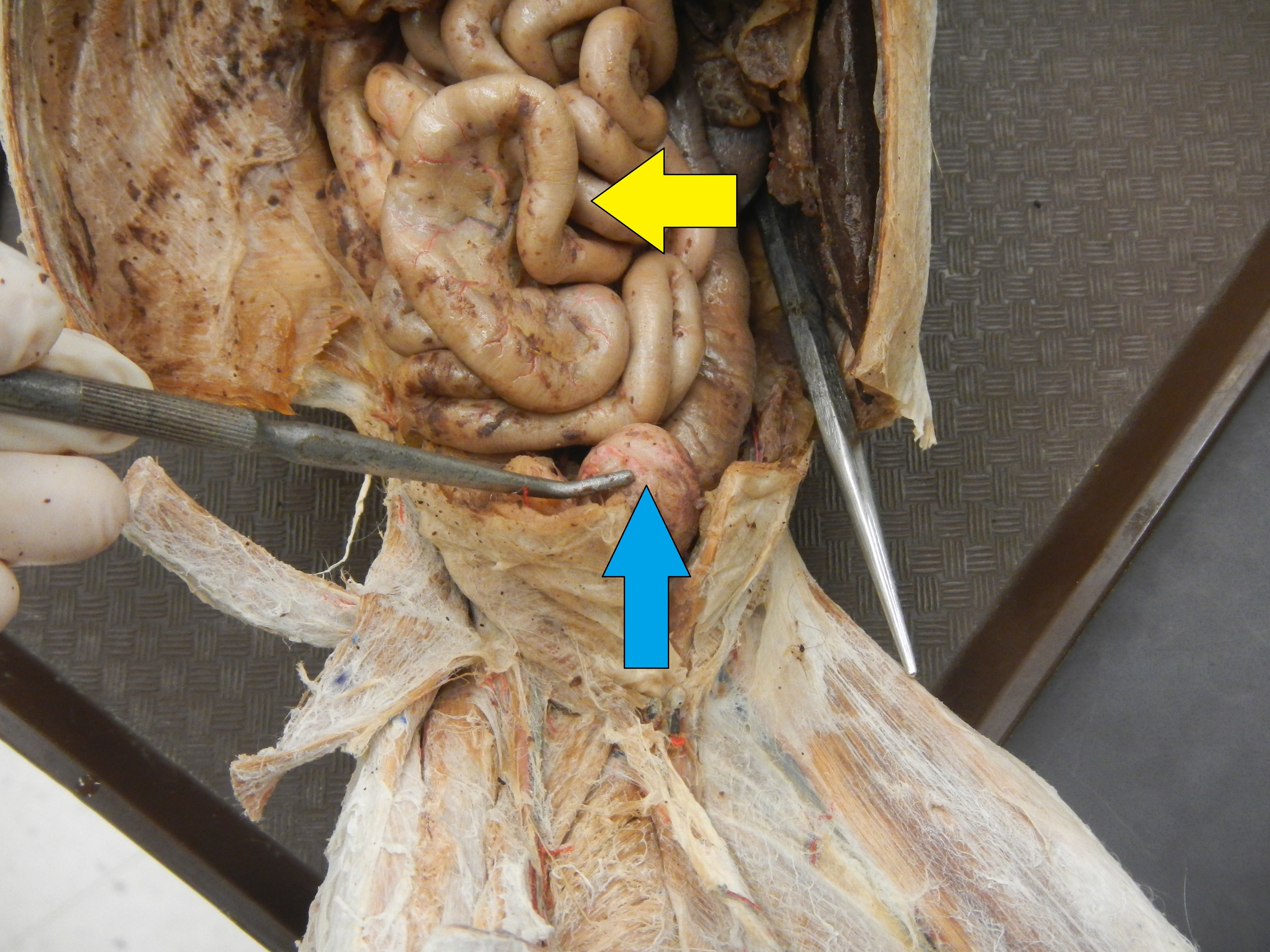 Blue - Urinary Bladder Yellow - Small Intestine