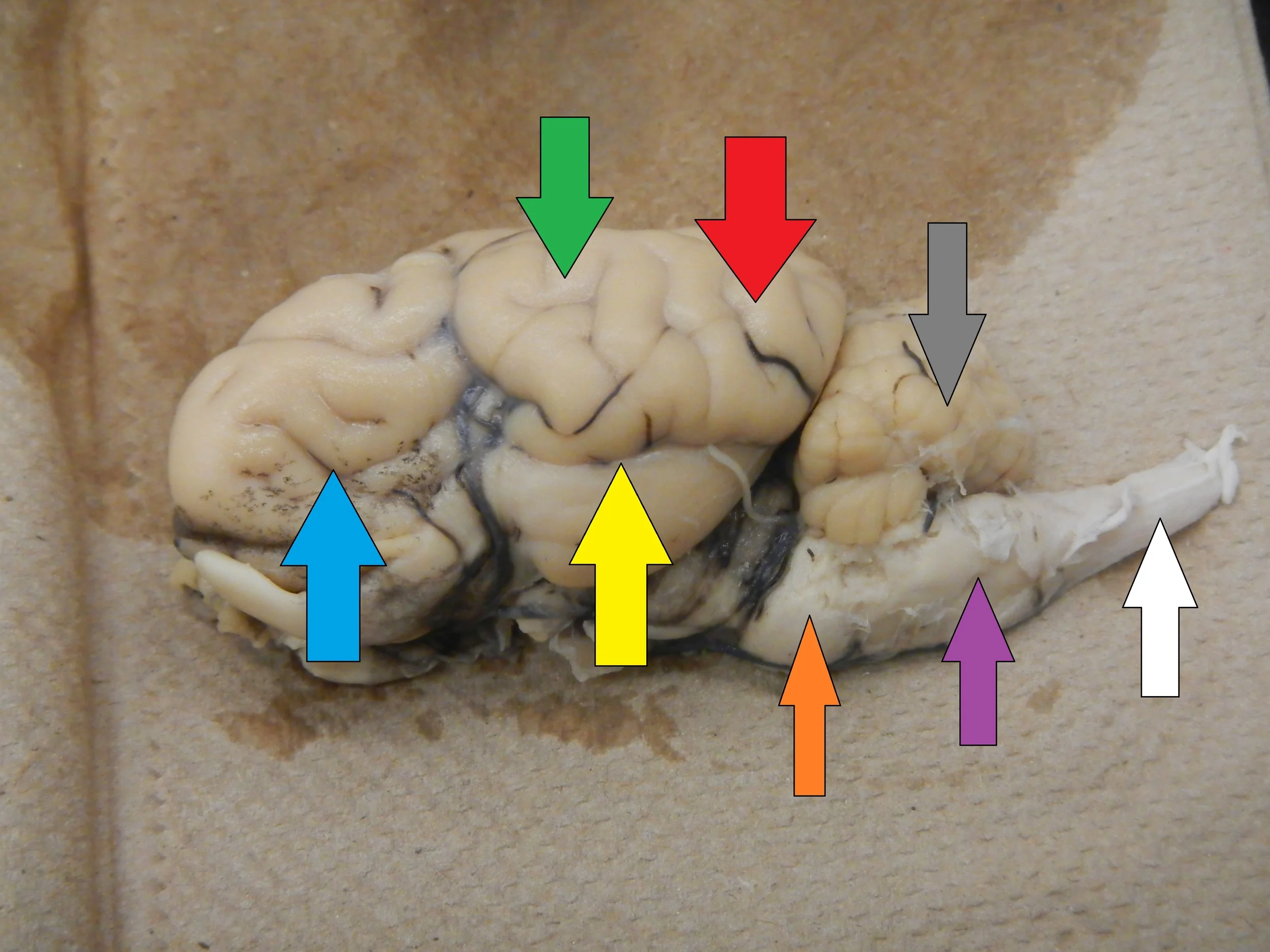 Blue - Frontal Area/Lobe Green - Parietal Area/Lobe Red - Occipital Area/Lobe Yellow - Temporal Area/Lobe Grey - Cerebellum Orange - Pons Purple - Medulla White - Spinal Cord
