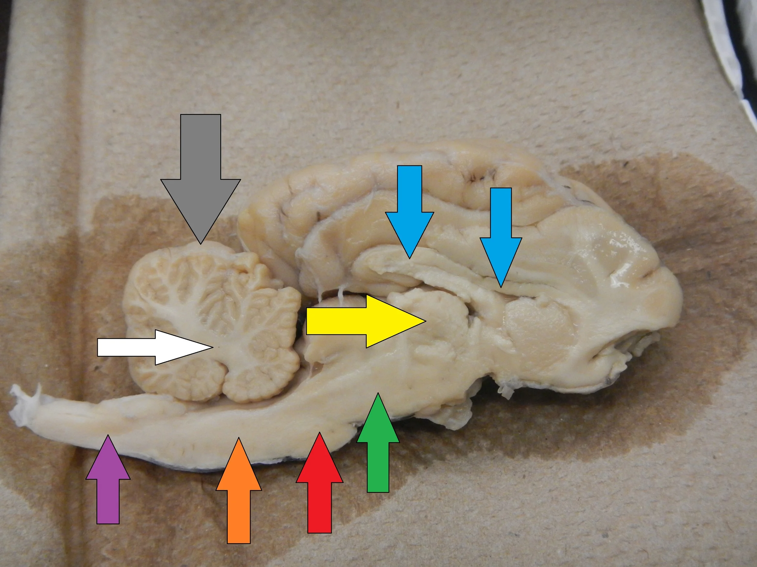 Blue - Corpus Callosum Yellow - Thalamus Green - Midbrain Red - Pons Orange - Medulla Purple - Spinal Cord Grey - Cerebellum White - Arbor Vitae