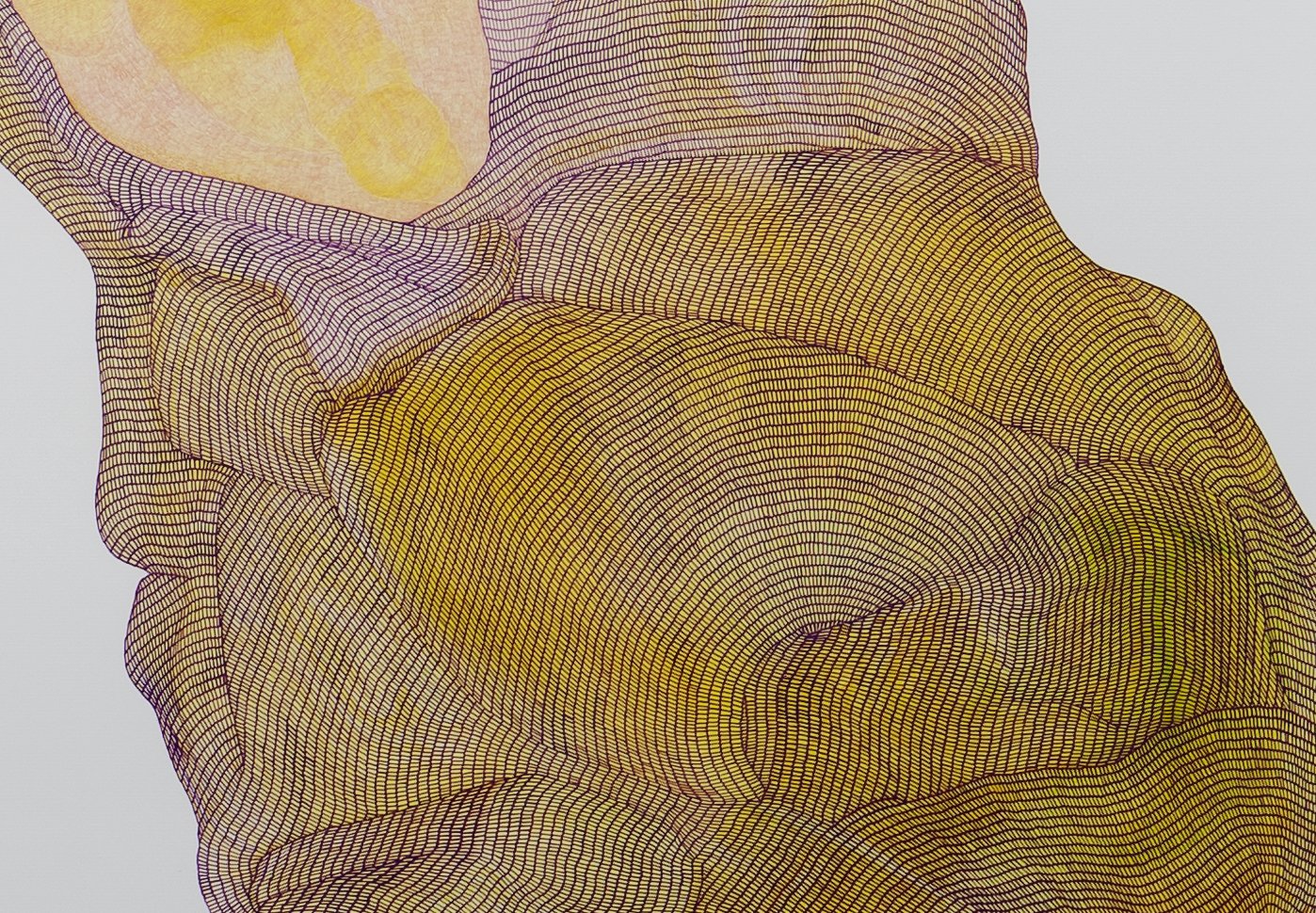 I'm sure it's nothing (detail)