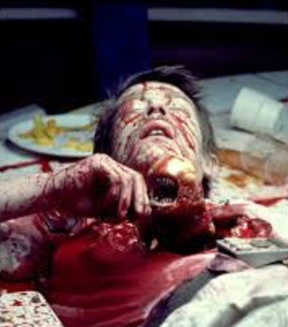 Just want to point out that this would never have happened if John Hurt had gone to the QA in Portsmouth with his really extreme Barrett's Oesophagus.