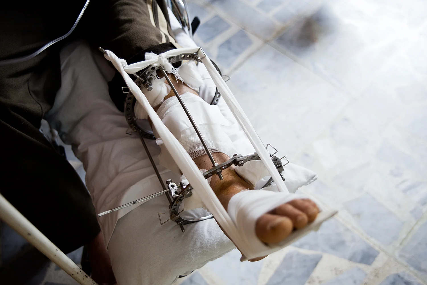  A common accessory at the hospital.   
  
   
  
    
  
   Normal 
   0 
   
   
   
   
   false 
   false 
   false 
   
   EN-US 
   JA 
   X-NONE 
   
  
  
  
  
  
  
  
  
  
  
   
   
  
  
  
  
  
  
  
  
  
  
  
    
    
  
   
   
 